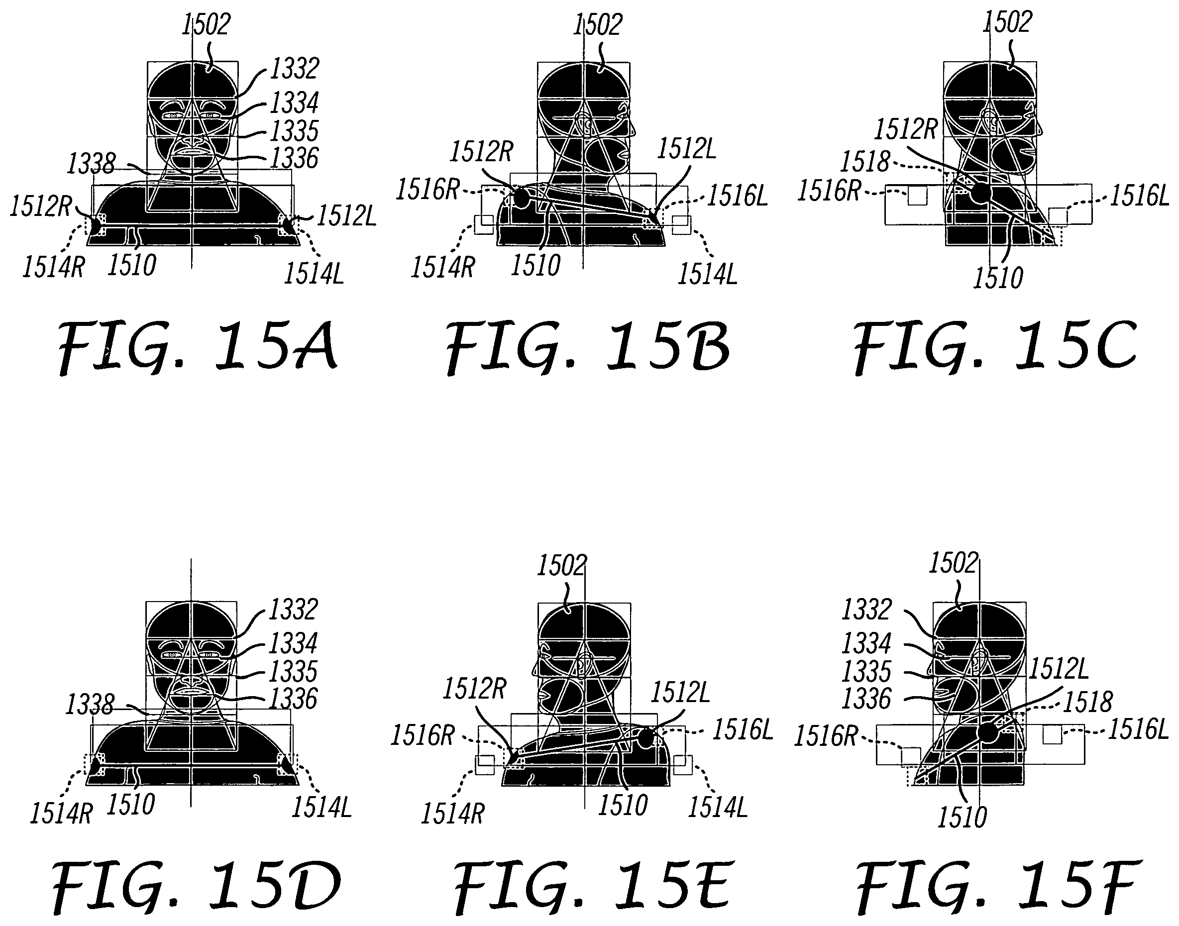 Patent US12112566 Figure 17 – System and method for using a video monitoring system to prevent and manage decubitus ulcers in patients
