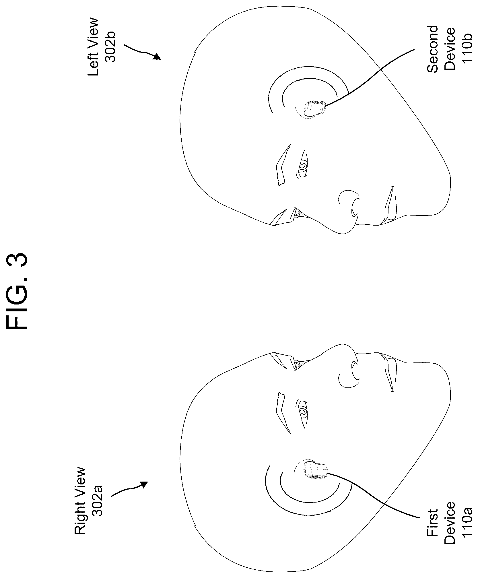 Patent US12112737 Figure 4 – Acoustic feedback control