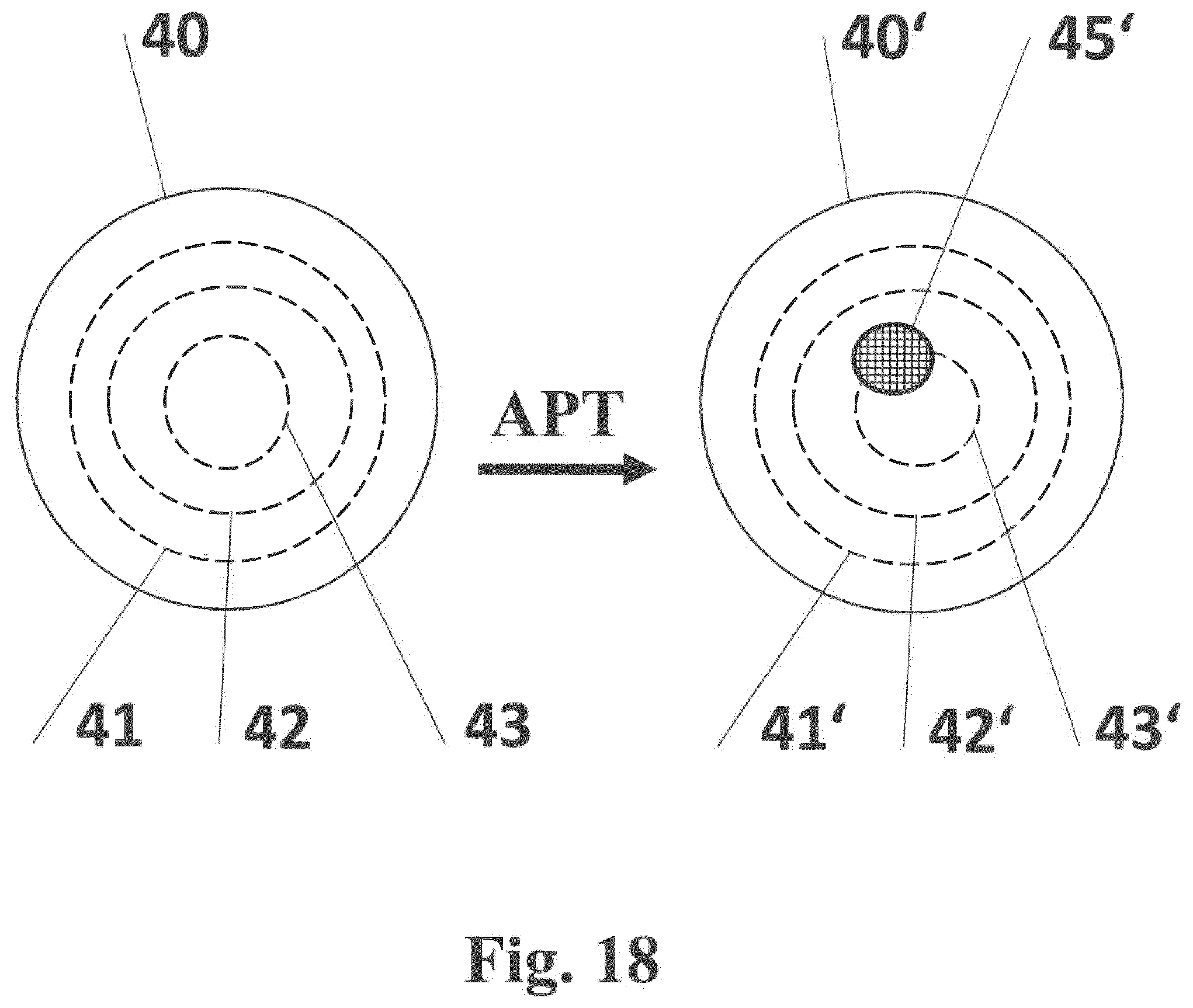 Patent US12112845 Figure 18 – Compartmentalized dynamic atlas