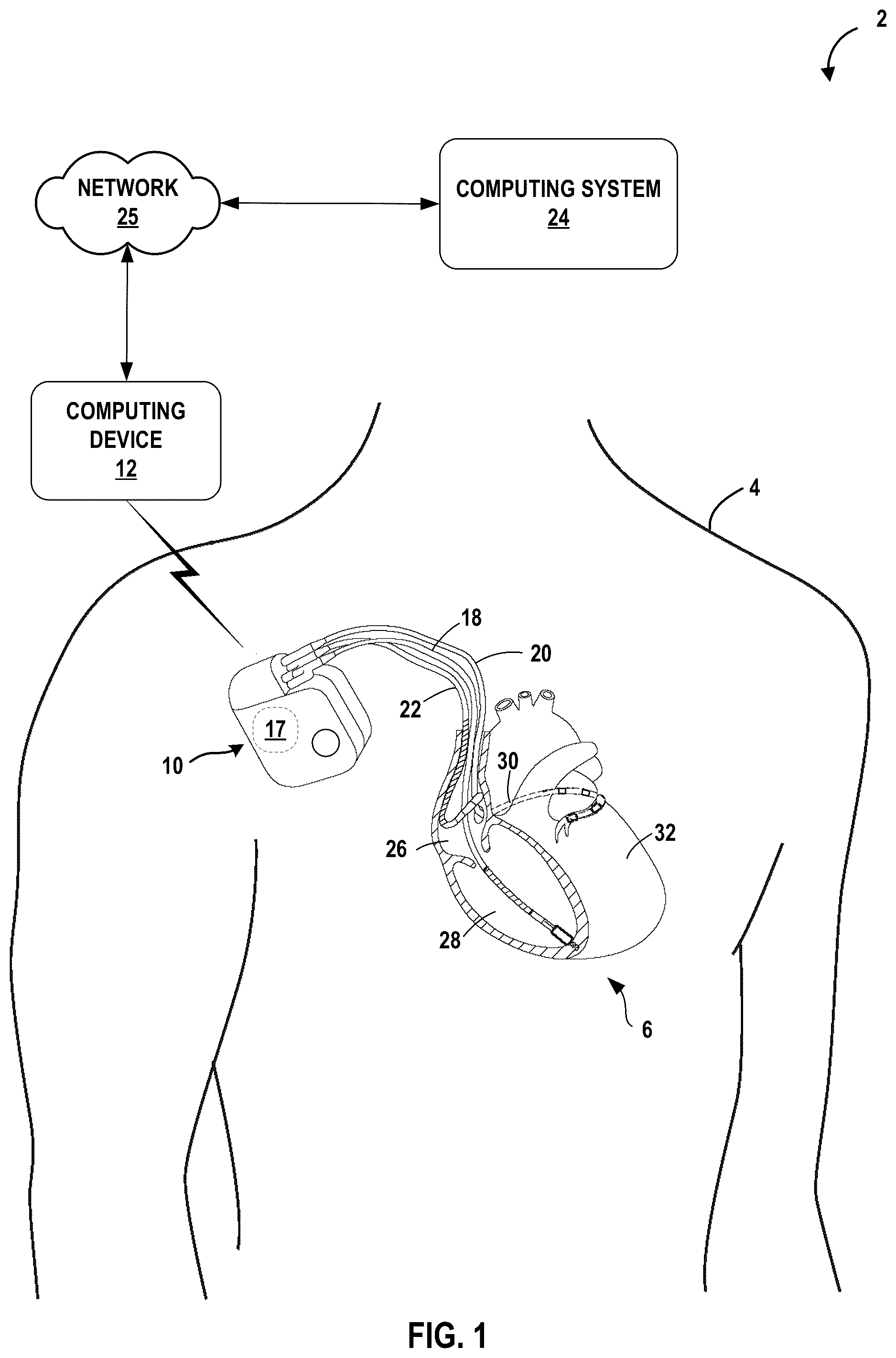 Patent US12112848 Figure 1 – System and method for core-device monitoring