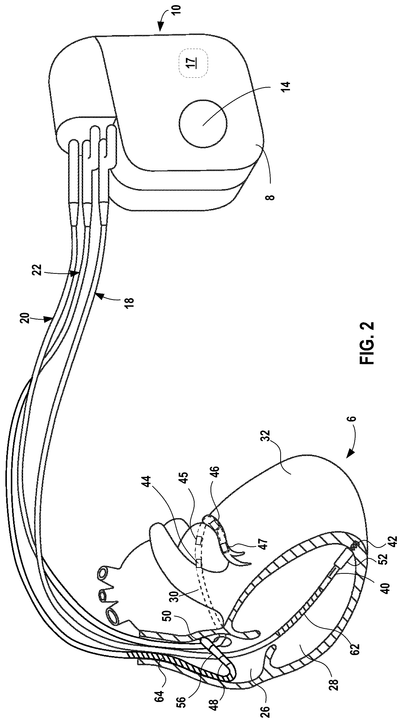 Patent US12112848 Figure 2 – System and method for core-device monitoring