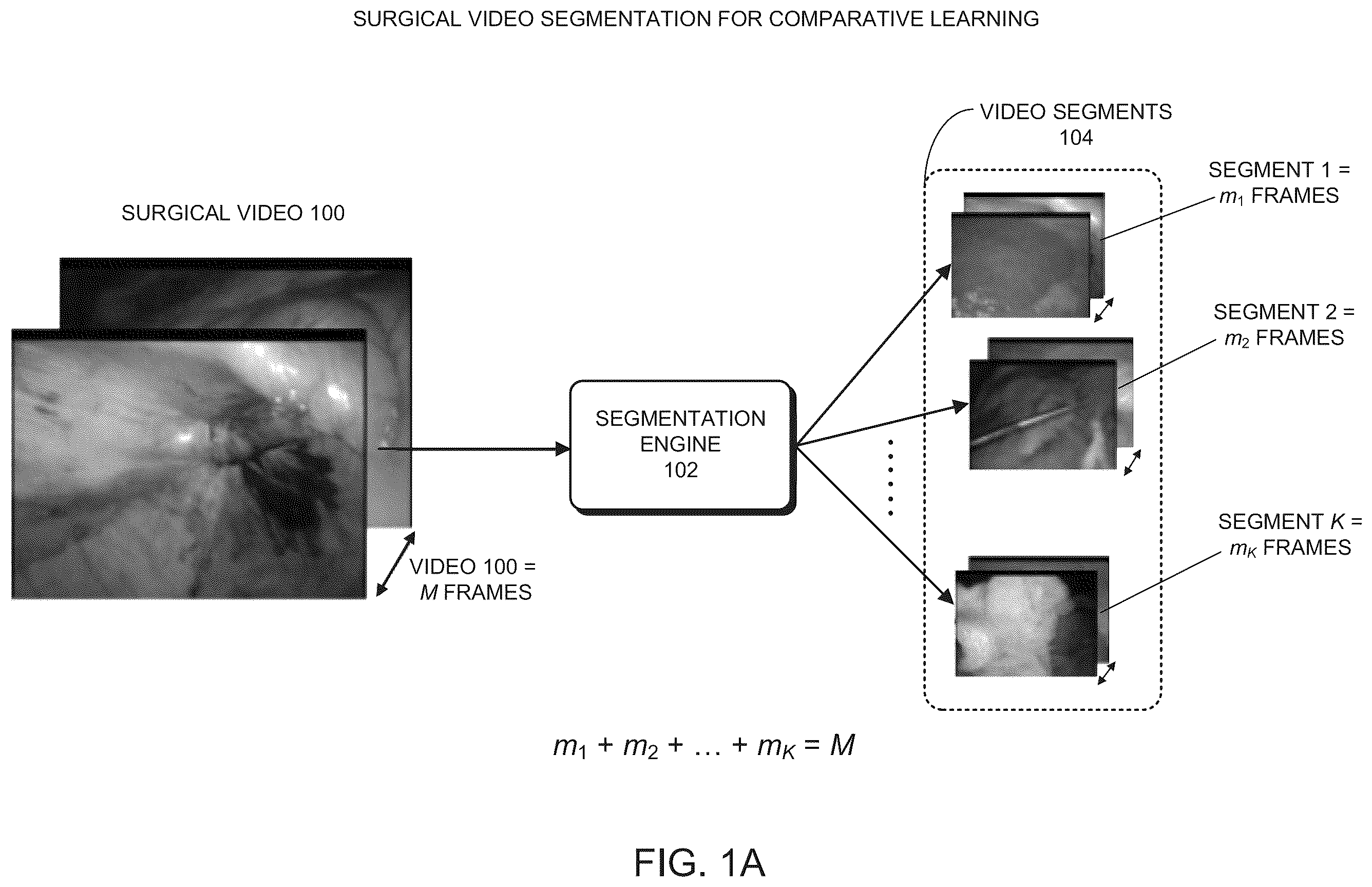 Patent US12120461 Figure 1 – Method and system for synchronizing playback of two recorded videos of the same surgical procedure
