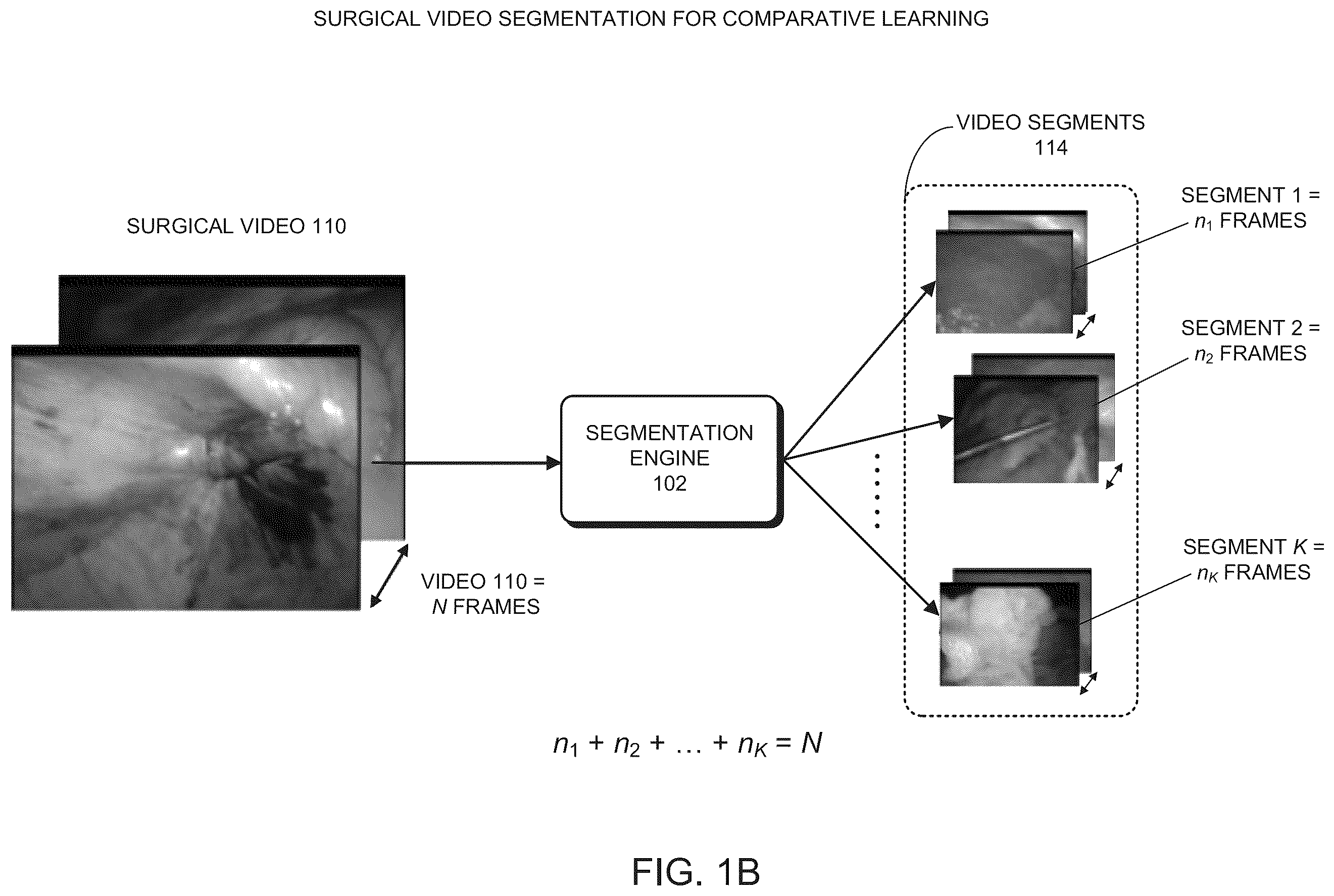 Patent US12120461 Figure 2 – Method and system for synchronizing playback of two recorded videos of the same surgical procedure
