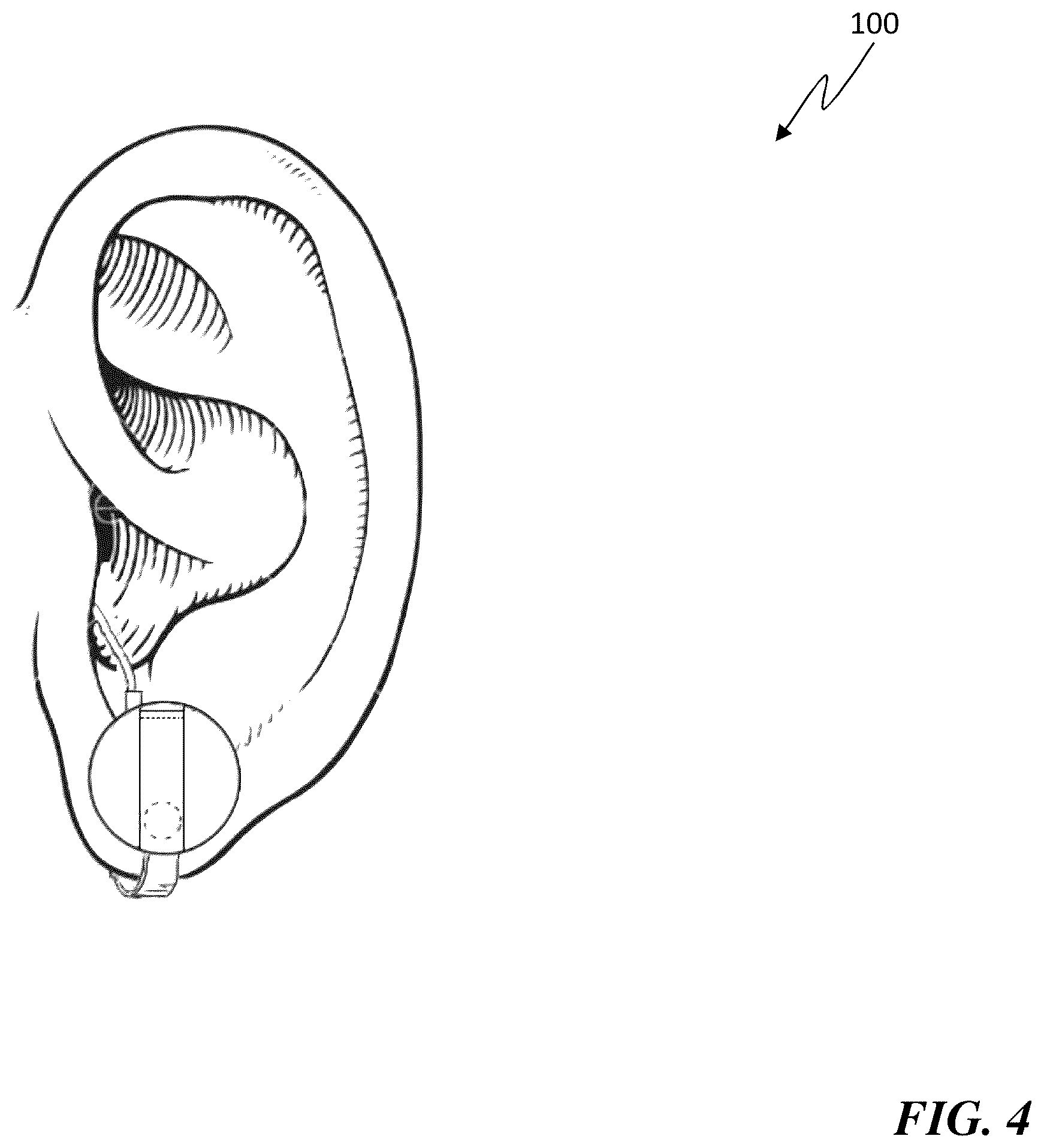 Patent US12120488 Figure 7 – Personal sound amplification article and method for implementing same