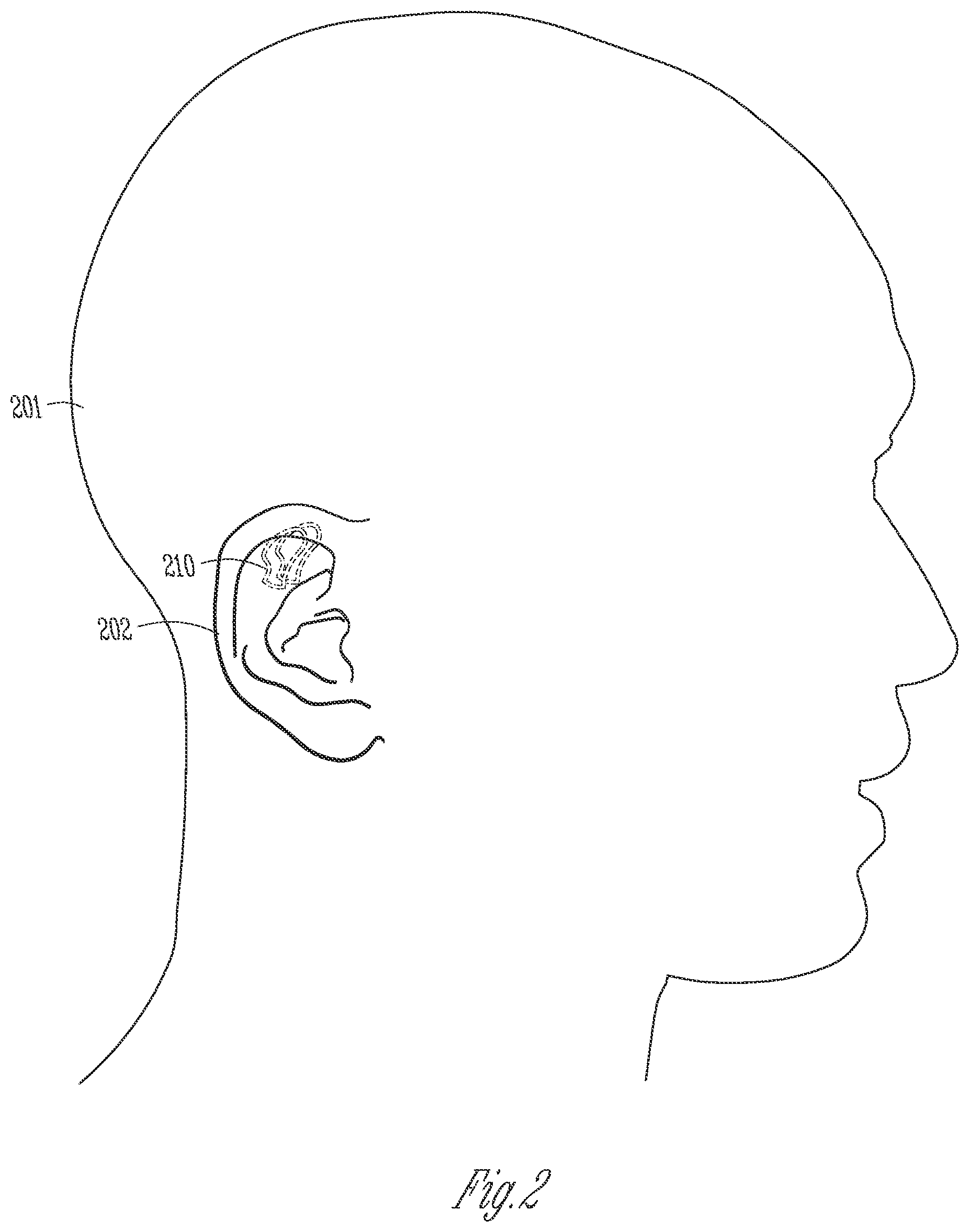 Patent US12126964 Figure 2 – Hearing device antenna with optimized orientation