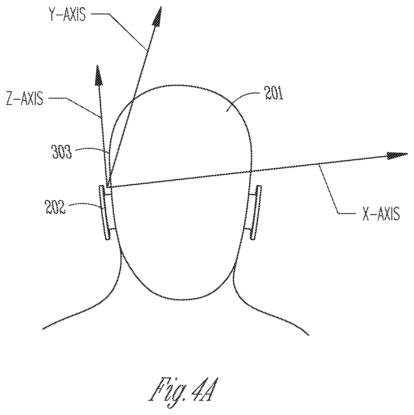 Patent US12126964 Figure 4 – Hearing device antenna with optimized orientation