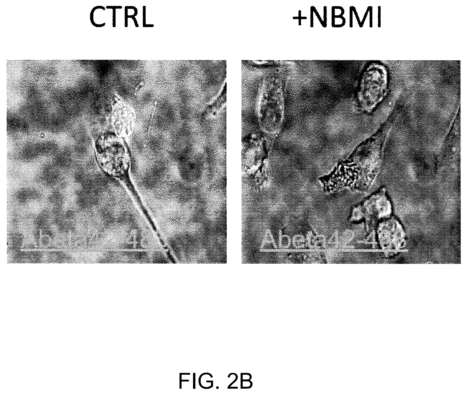 Patent US12128017 Figure 3 – N,N-bis-2-mercaptoethyl isophthalamide for the treatment of neurodegenerative diseases