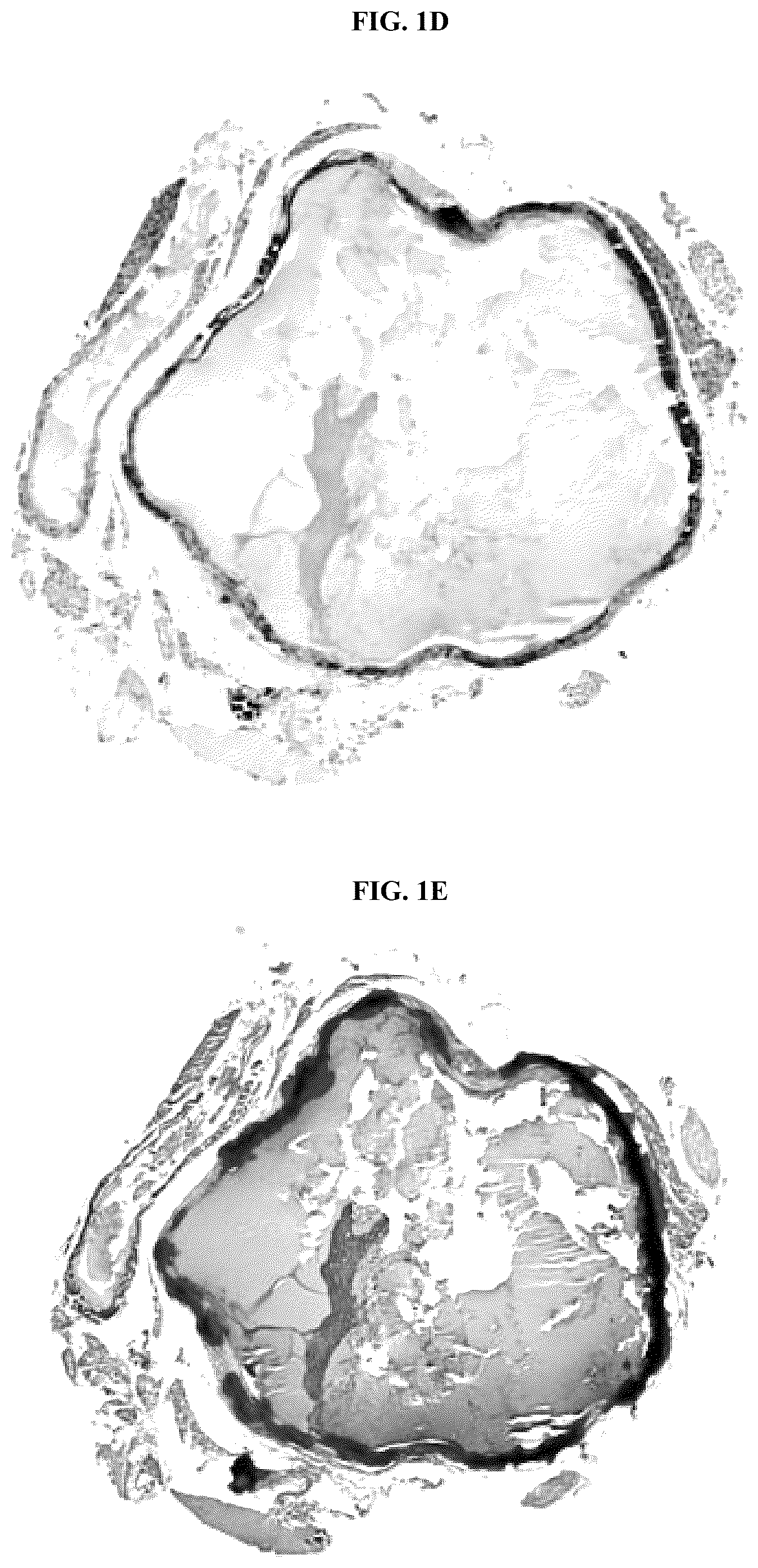 Patent US12128087 Figure 3 – Compositions for treating pathological calcification conditions, and methods using same