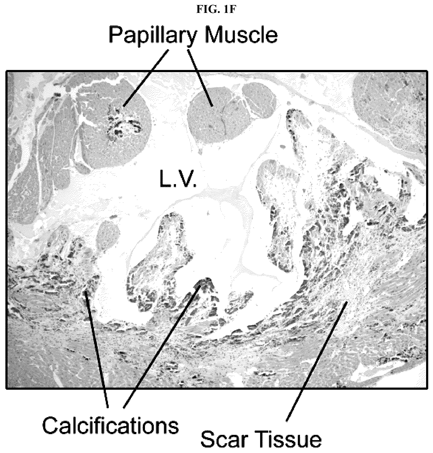 Patent US12128087 Figure 4 – Compositions for treating pathological calcification conditions, and methods using same
