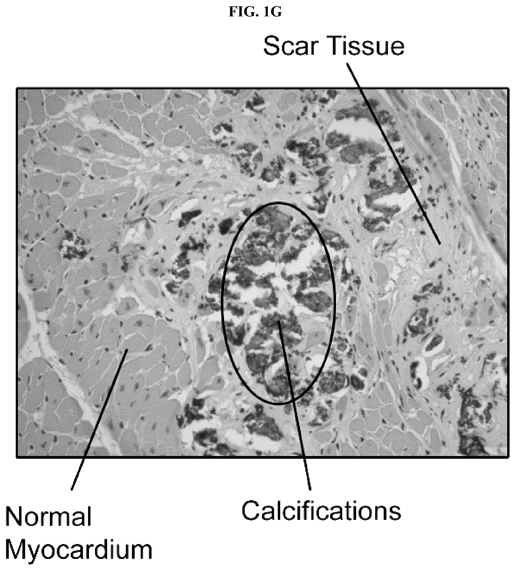 Patent US12128087 Figure 5 – Compositions for treating pathological calcification conditions, and methods using same