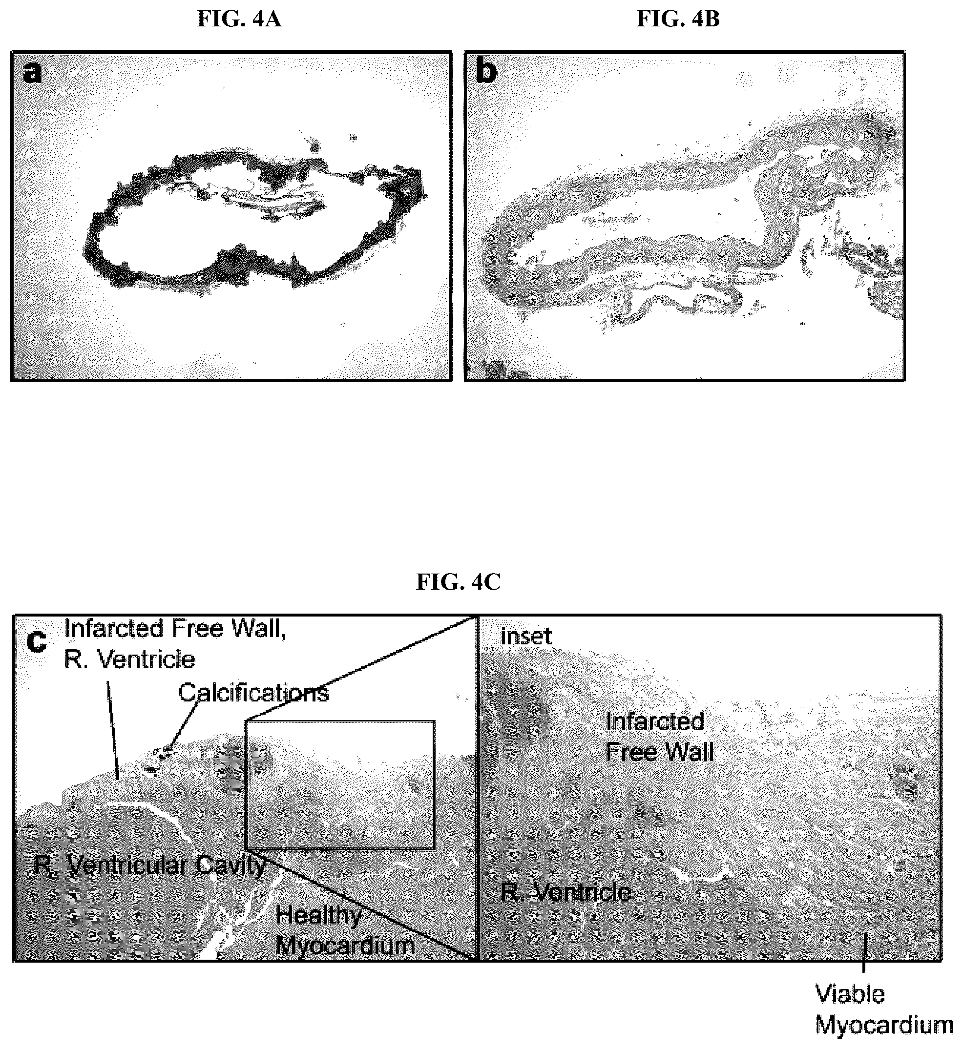 Patent US12128087 Figure 13 – Compositions for treating pathological calcification conditions, and methods using same