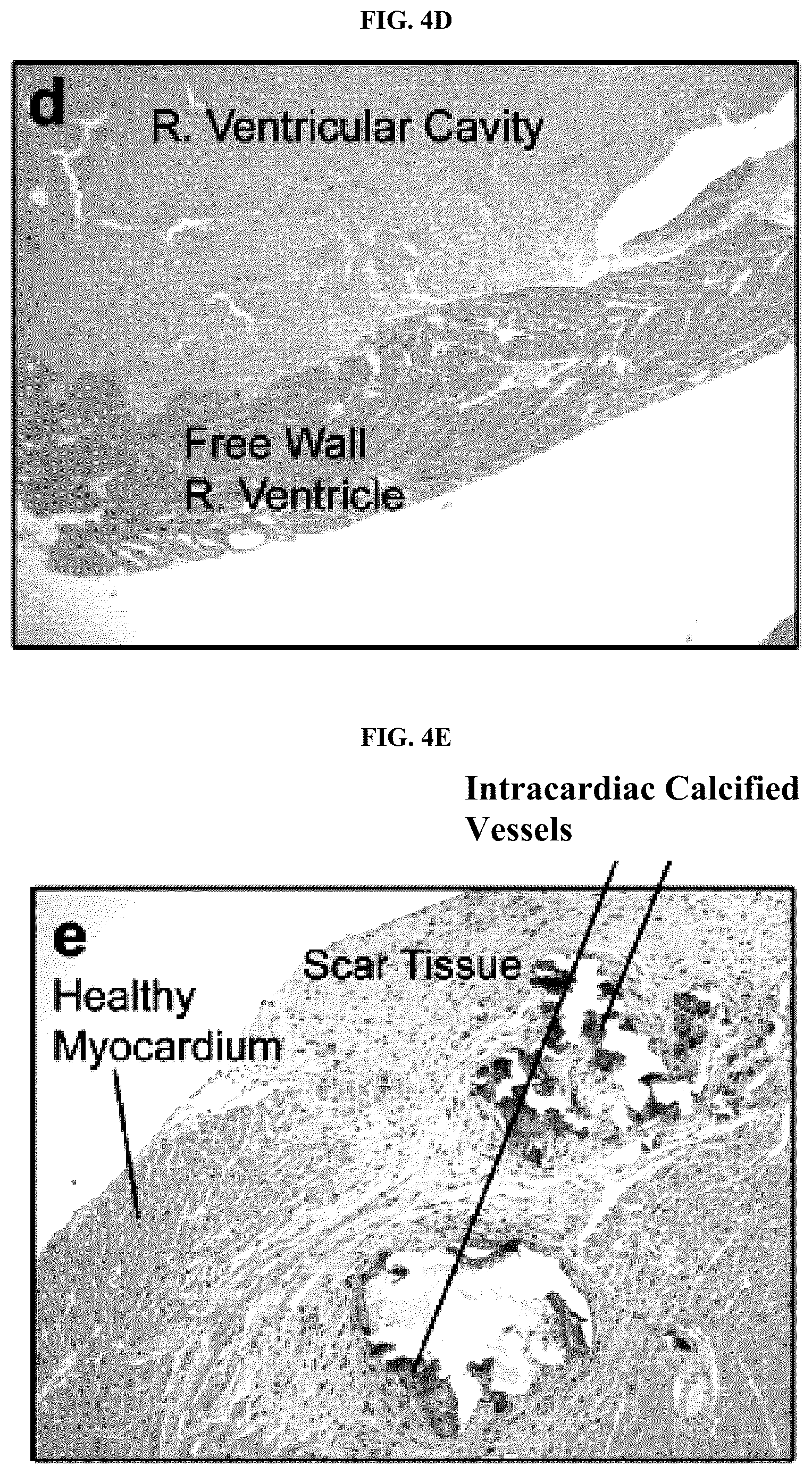 Patent US12128087 Figure 14 – Compositions for treating pathological calcification conditions, and methods using same