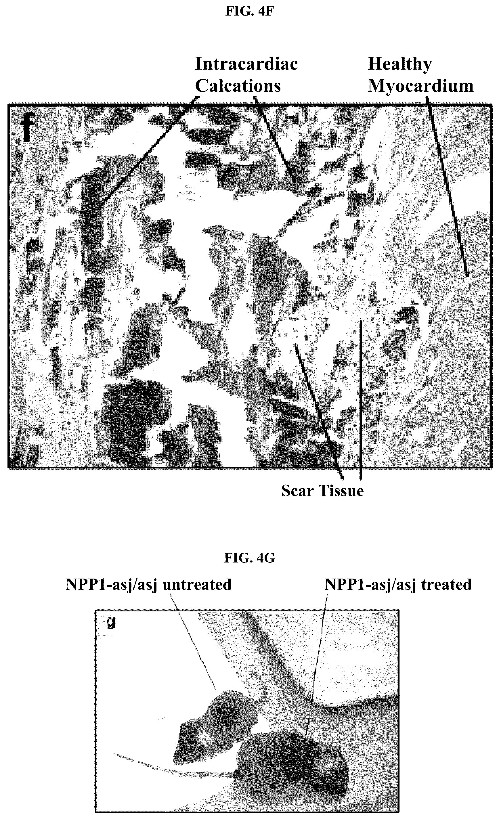 Patent US12128087 Figure 15 – Compositions for treating pathological calcification conditions, and methods using same