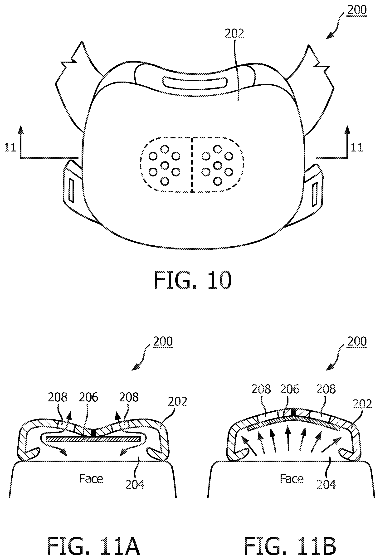 Patent US12128186 Figure 6 – Patient interface valve arrangment