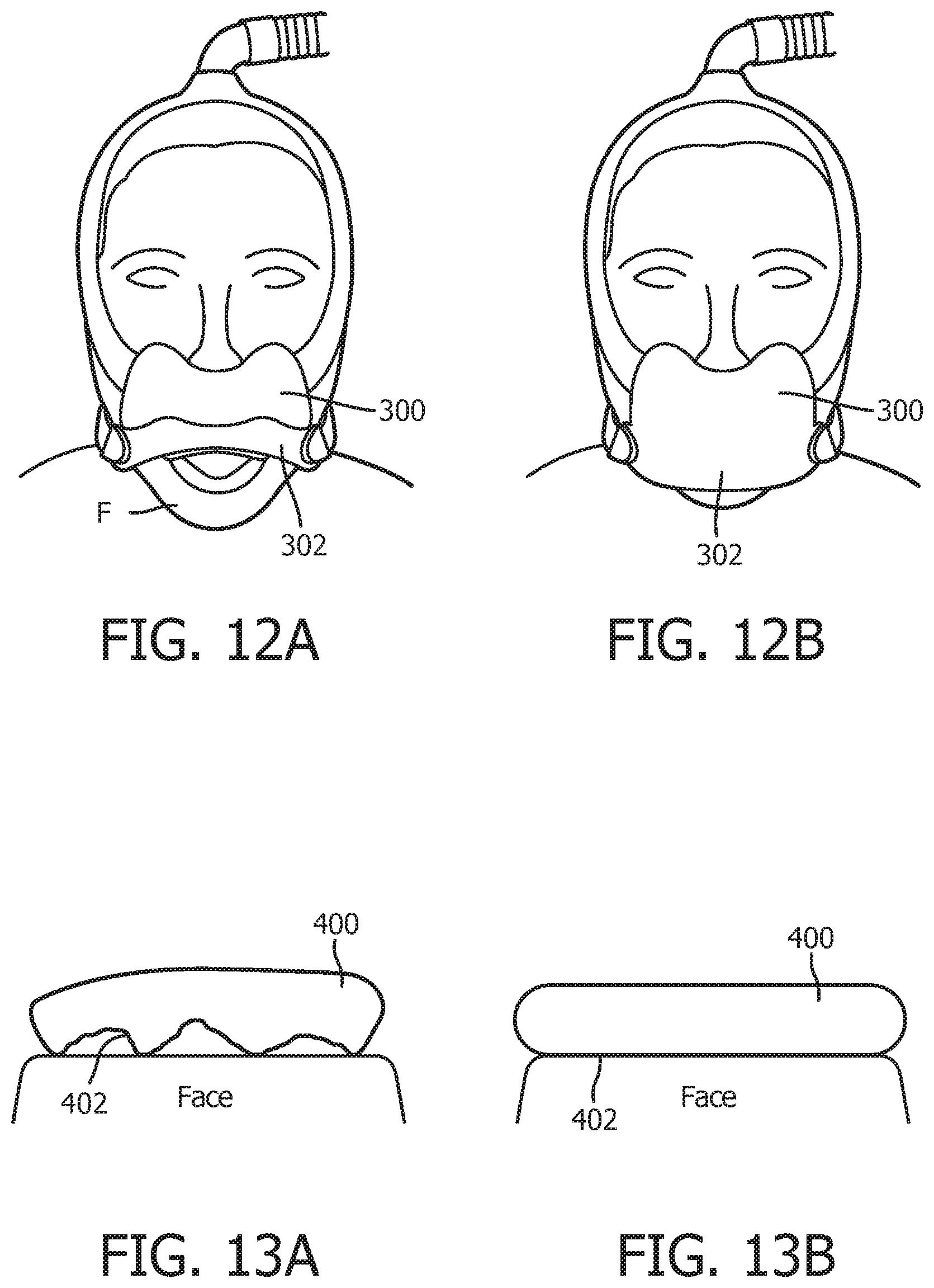 Patent US12128186 Figure 7 – Patient interface valve arrangment