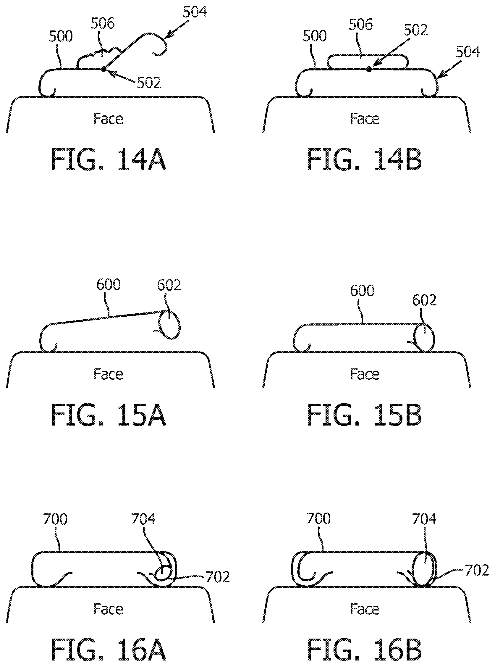 Patent US12128186 Figure 8 – Patient interface valve arrangment