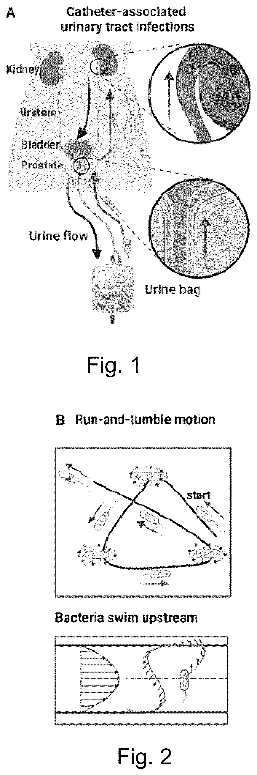 Patent US12128189 Figure 1 – Anti-infection fluidic channel