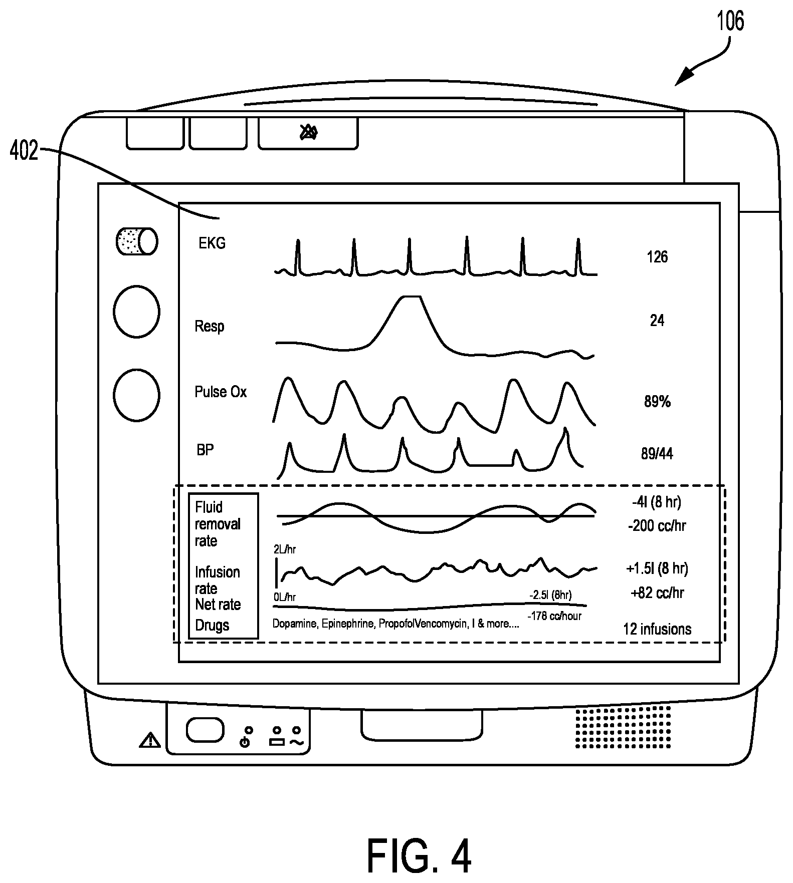 Patent US12128216 Figure 3 – Medical device data integration apparatus and methods