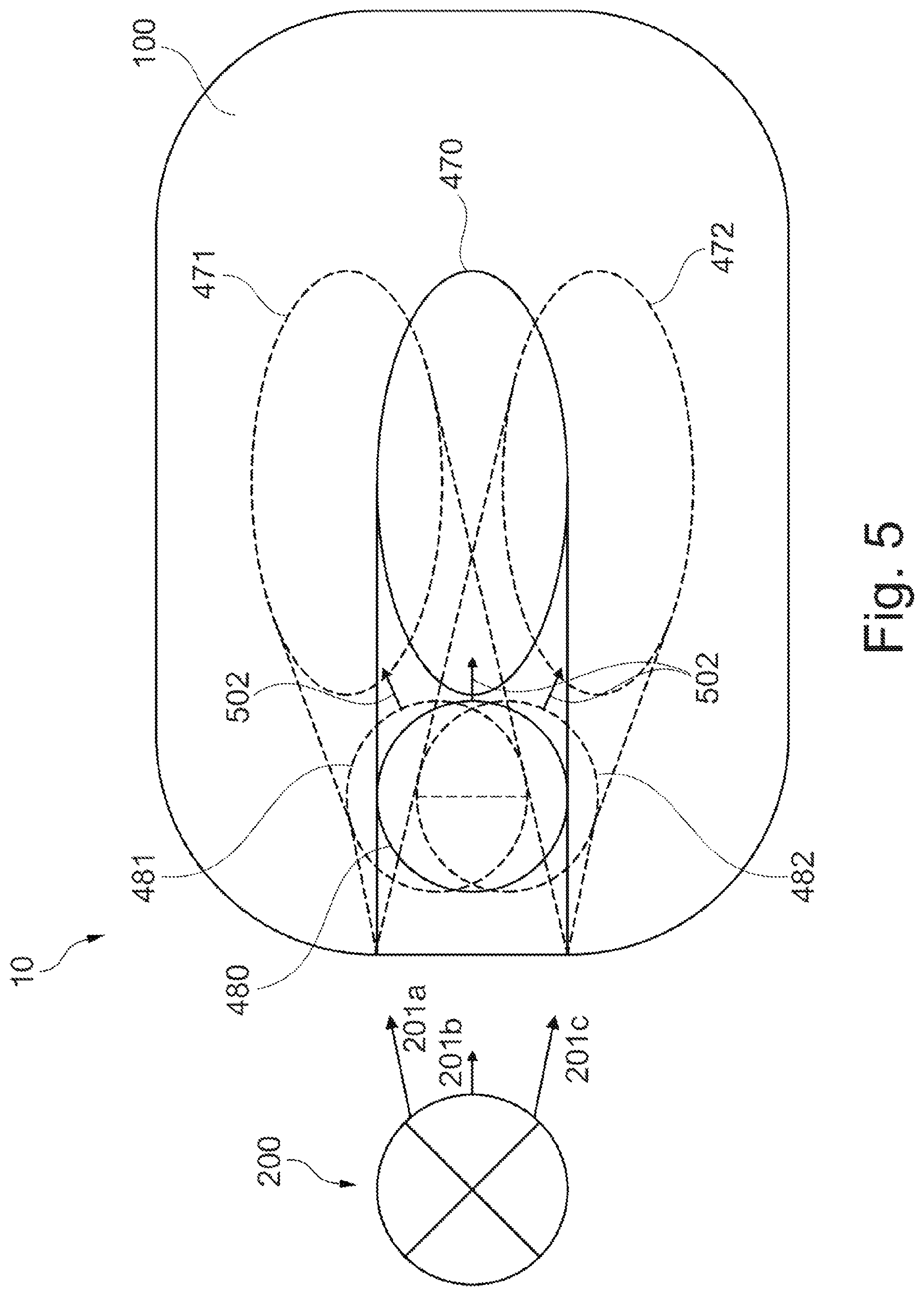 Patent US12128243 Figure 6 – Devices for supplying energy to an active eye implant