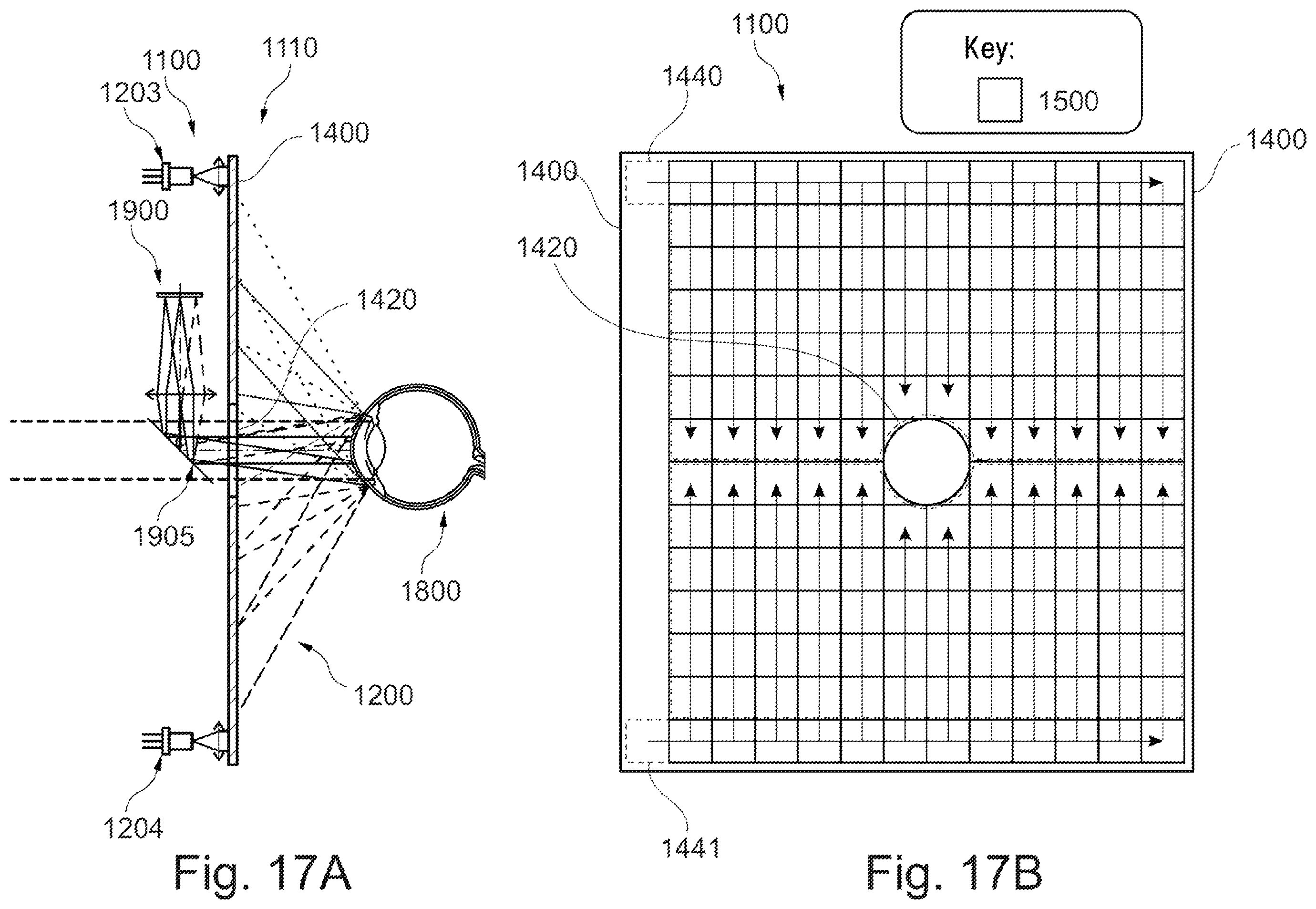 Patent US12128243 Figure 18 – Devices for supplying energy to an active eye implant