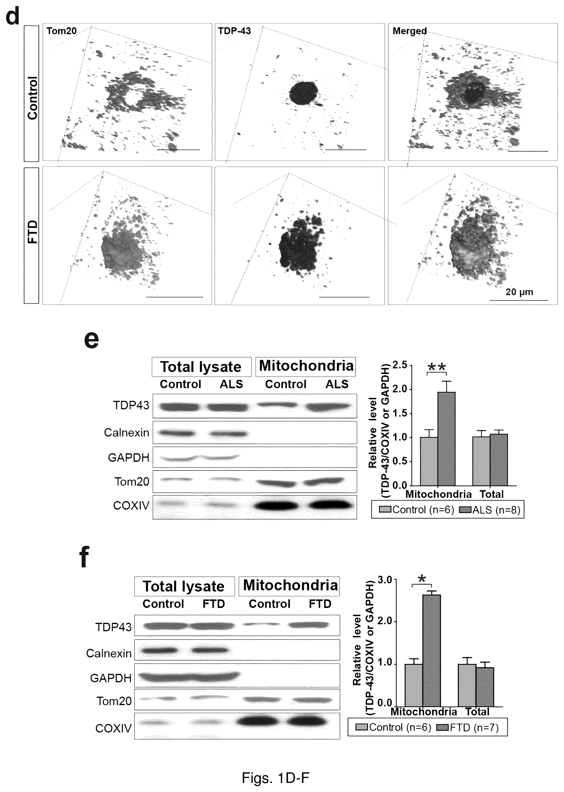 Patent US12129285 Figure 2 – TDP-43 mitochondrial localization inhibitor for the treatment of neurogenerative disease