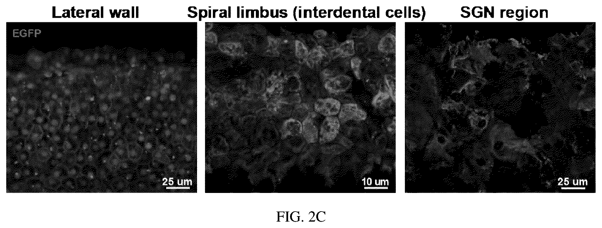Patent US12129287 Figure 4 – Recombinant adeno associated virus encoding clarin-1 and uses thereof