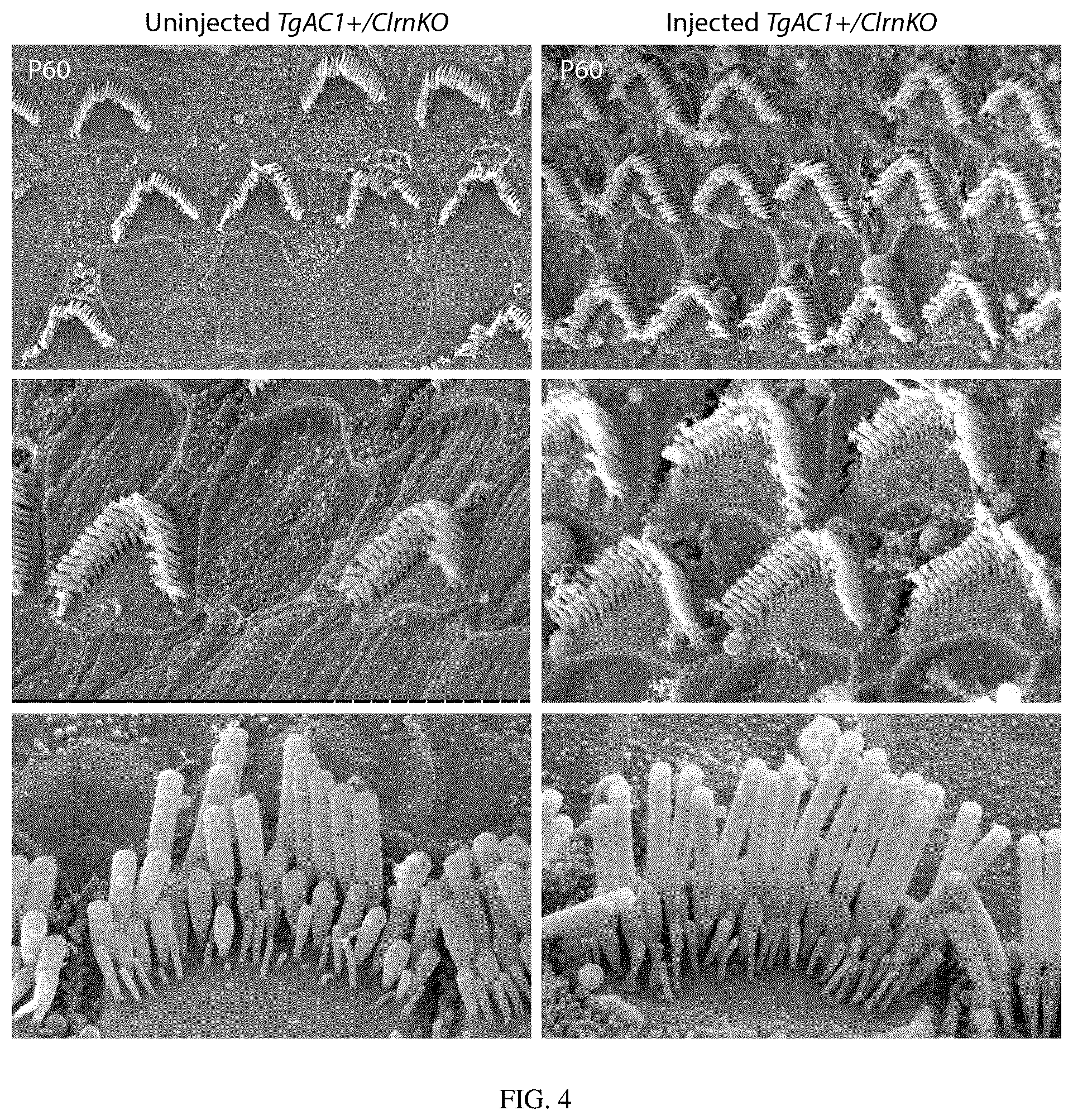 Patent US12129287 Figure 7 – Recombinant adeno associated virus encoding clarin-1 and uses thereof