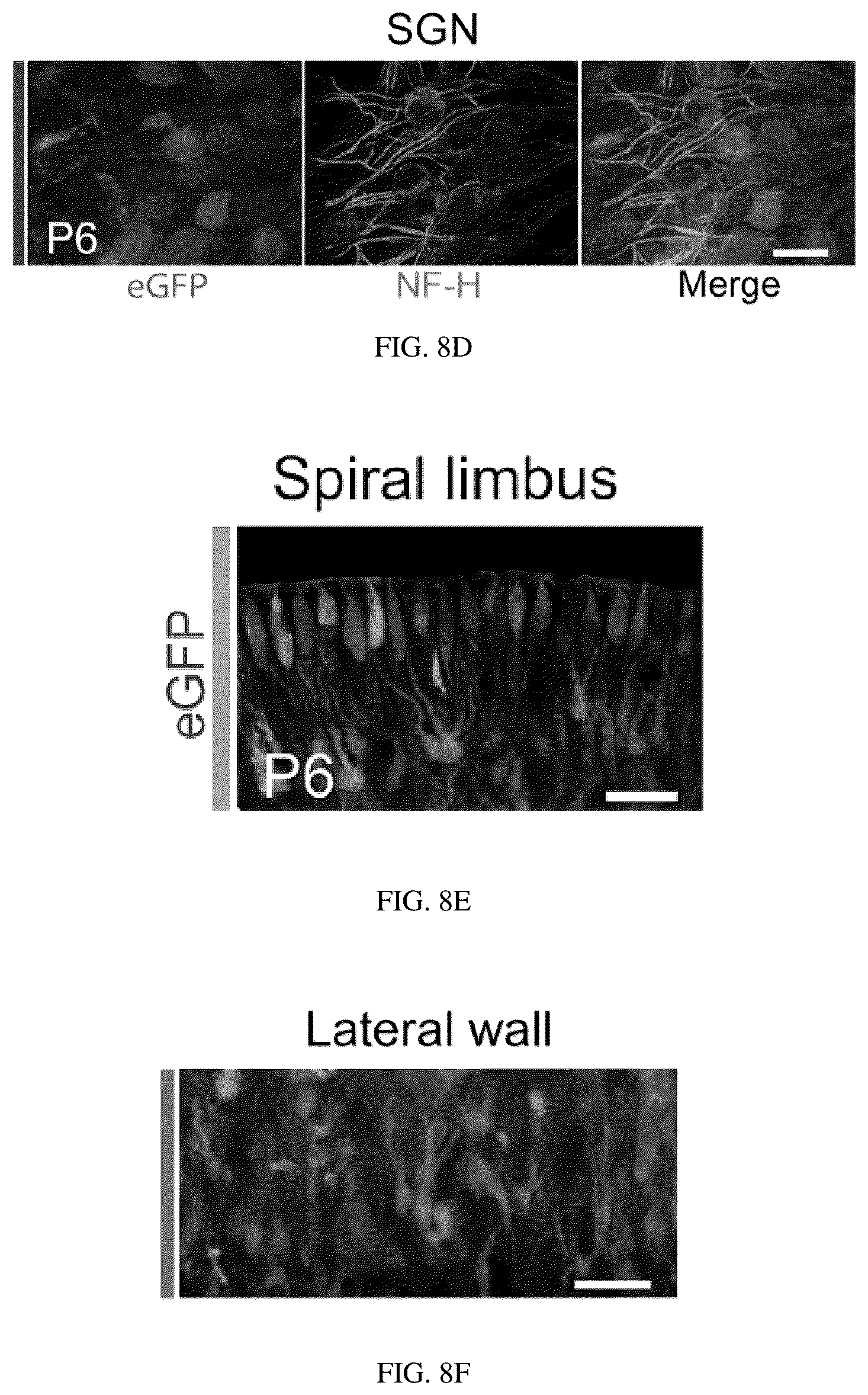 Patent US12129287 Figure 12 – Recombinant adeno associated virus encoding clarin-1 and uses thereof
