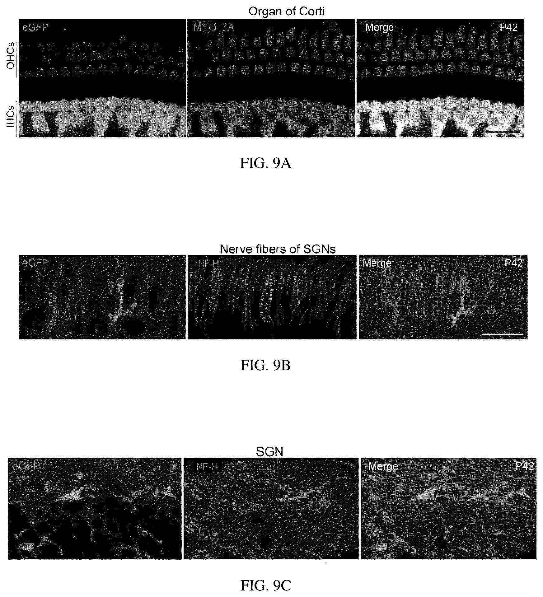 Patent US12129287 Figure 15 – Recombinant adeno associated virus encoding clarin-1 and uses thereof