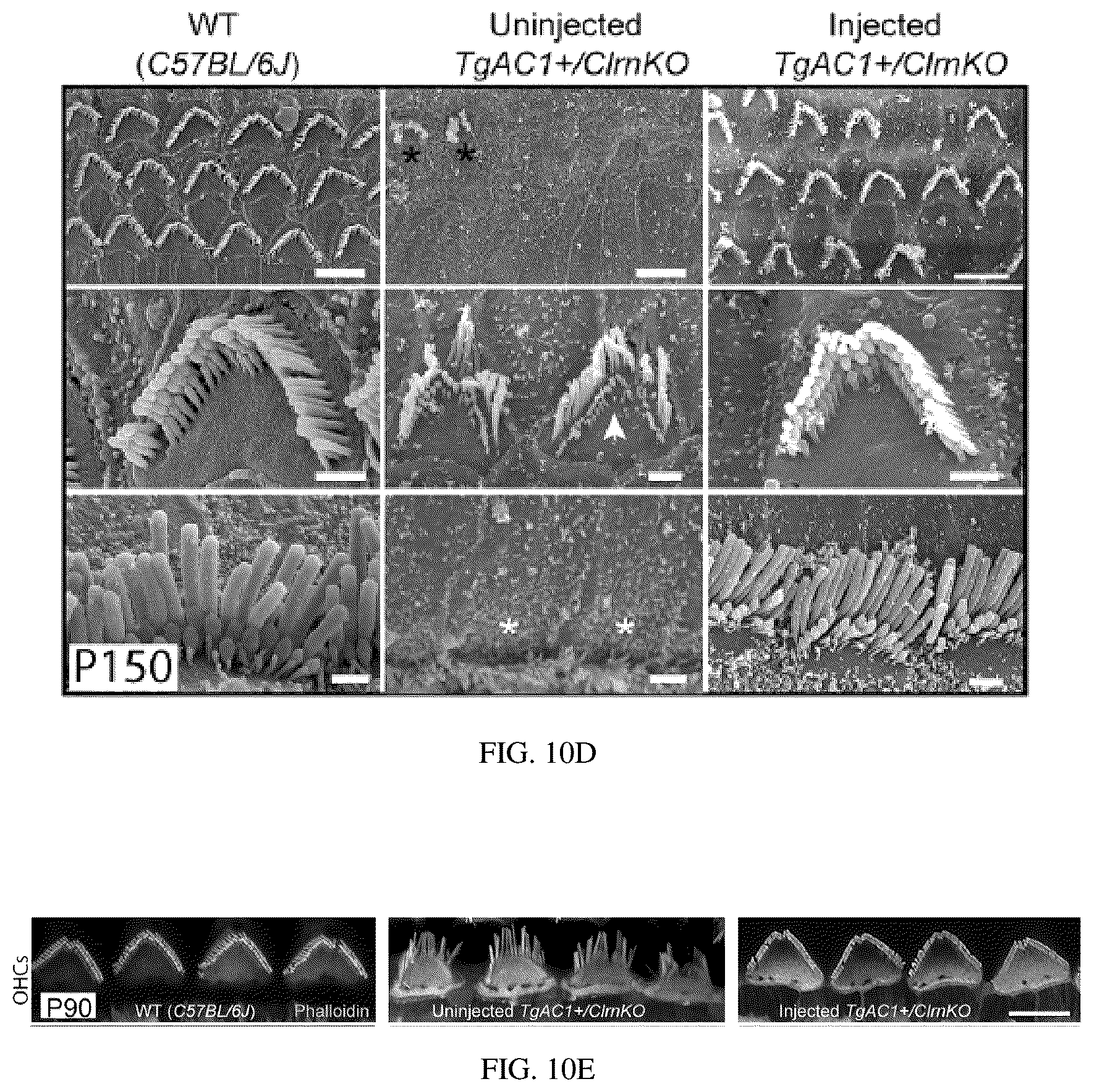 Patent US12129287 Figure 19 – Recombinant adeno associated virus encoding clarin-1 and uses thereof