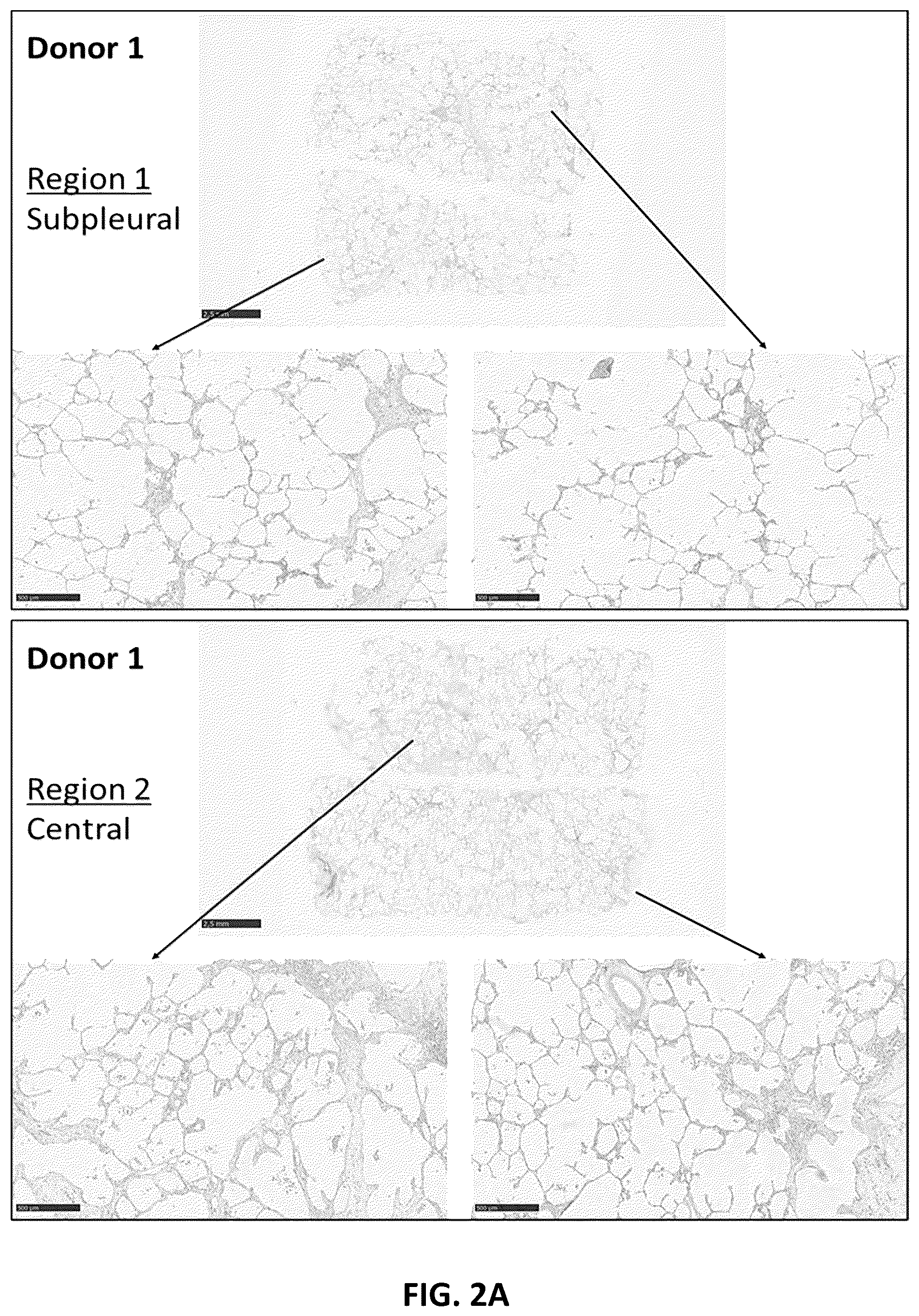 Patent US12129303 Figure 3 – Anti-interleukin-11 receptor subunit α (IL-11Rα) antibodies