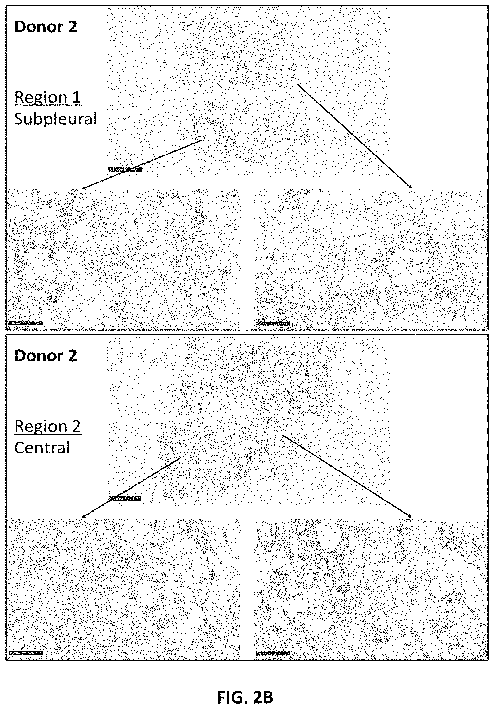 Patent US12129303 Figure 4 – Anti-interleukin-11 receptor subunit α (IL-11Rα) antibodies