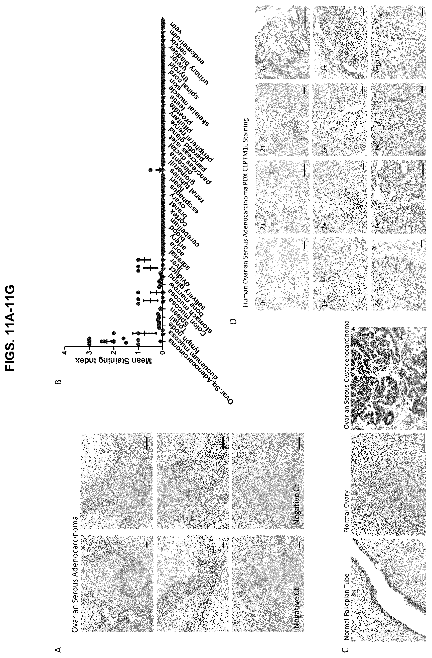 Patent US12129305 Figure 11 – Targeting CLPTM1L for treatment and prevention of cancer