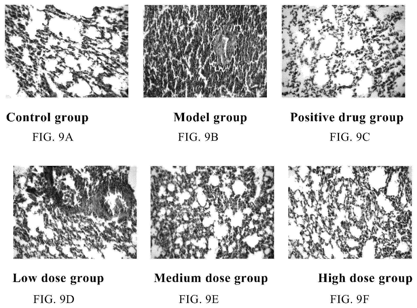 Patent US12129315 Figure 11 – Monomeric polysaccharide isolated from Auricularia auricula -judae, and preparation method and use thereof