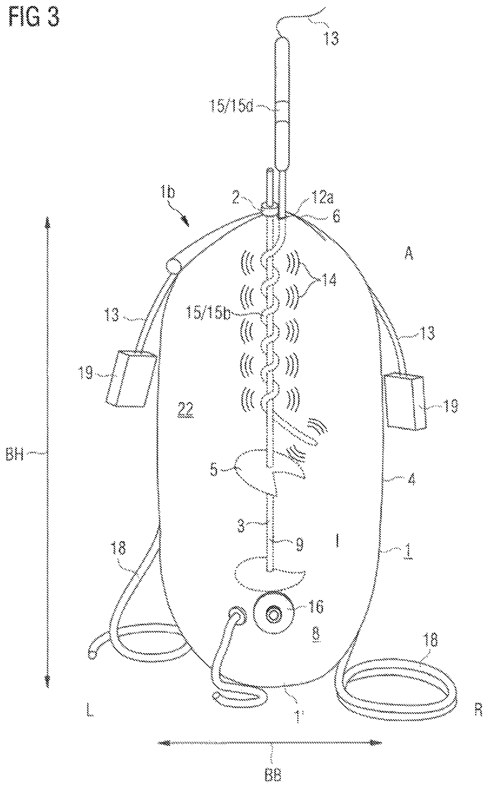 Patent US12129457 Figure 3 – Illumination for a photobioreactor