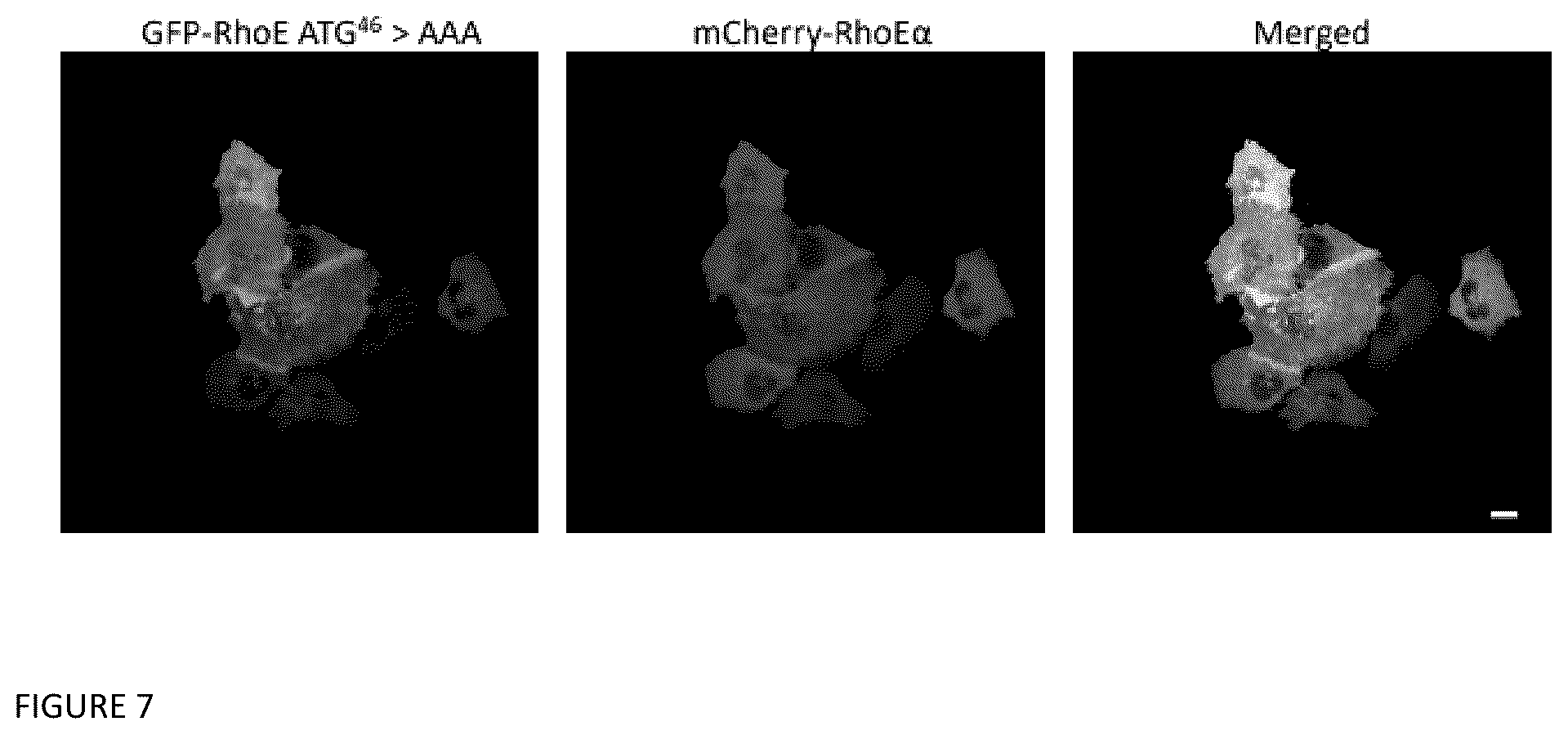 Patent US12129470 Figure 7 – Methods and compositions related to RNA-targeted Rho small GTPase RND3/RhoE therapy