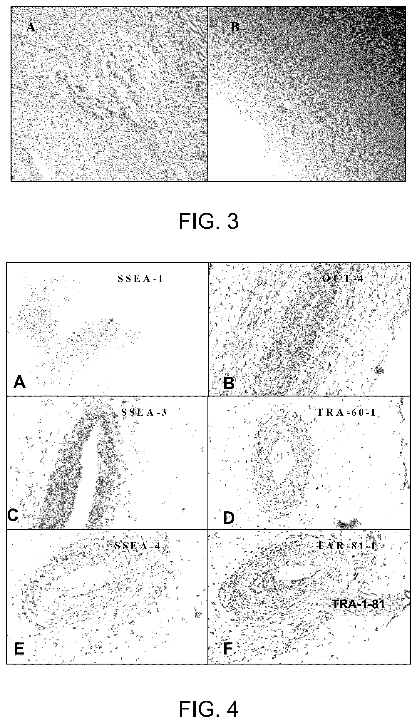 Patent US12129481 Figure 2 – Use of cells derived from first trimester umbilical cord tissue