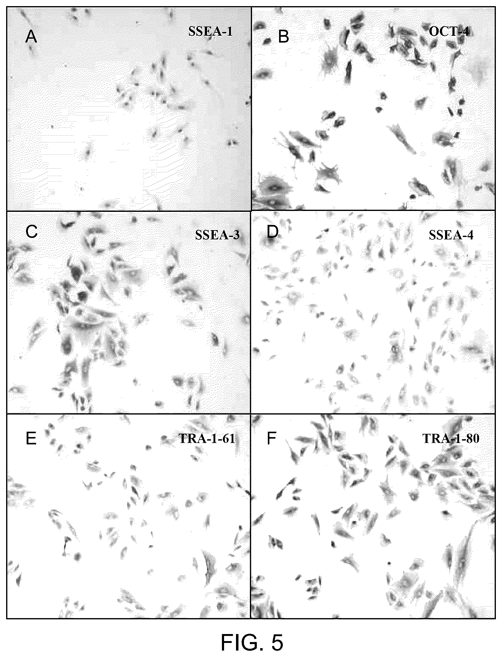 Patent US12129481 Figure 3 – Use of cells derived from first trimester umbilical cord tissue