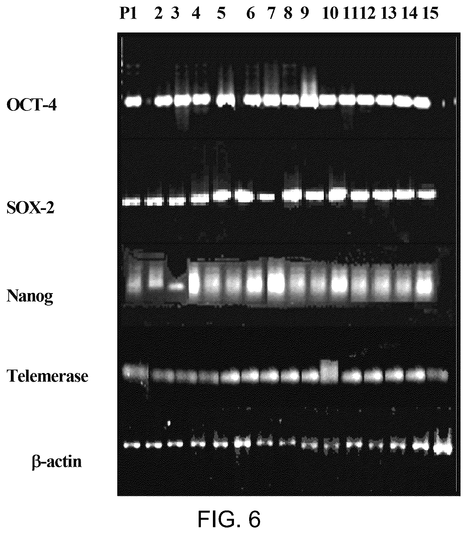 Patent US12129481 Figure 4 – Use of cells derived from first trimester umbilical cord tissue