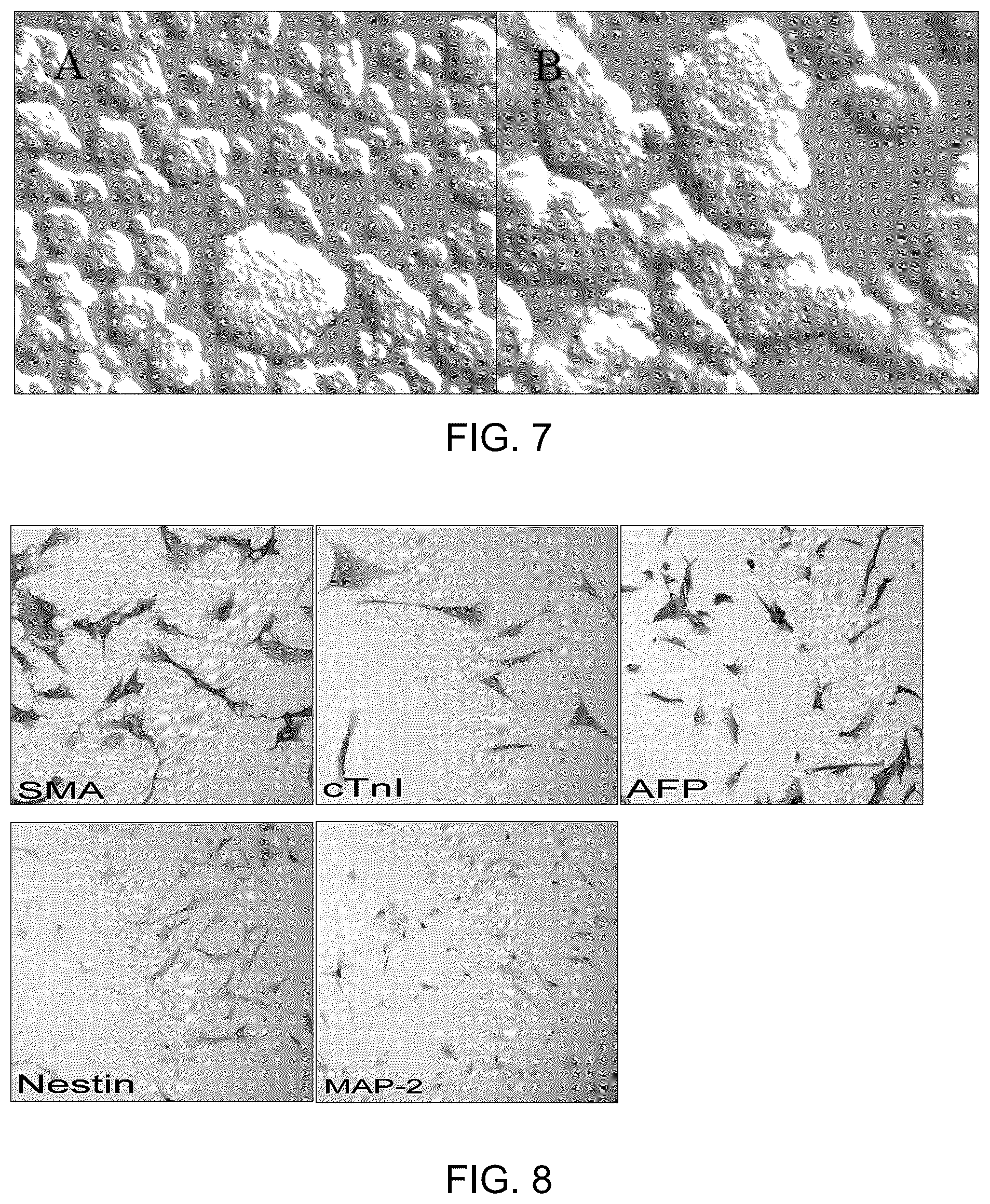 Patent US12129481 Figure 5 – Use of cells derived from first trimester umbilical cord tissue