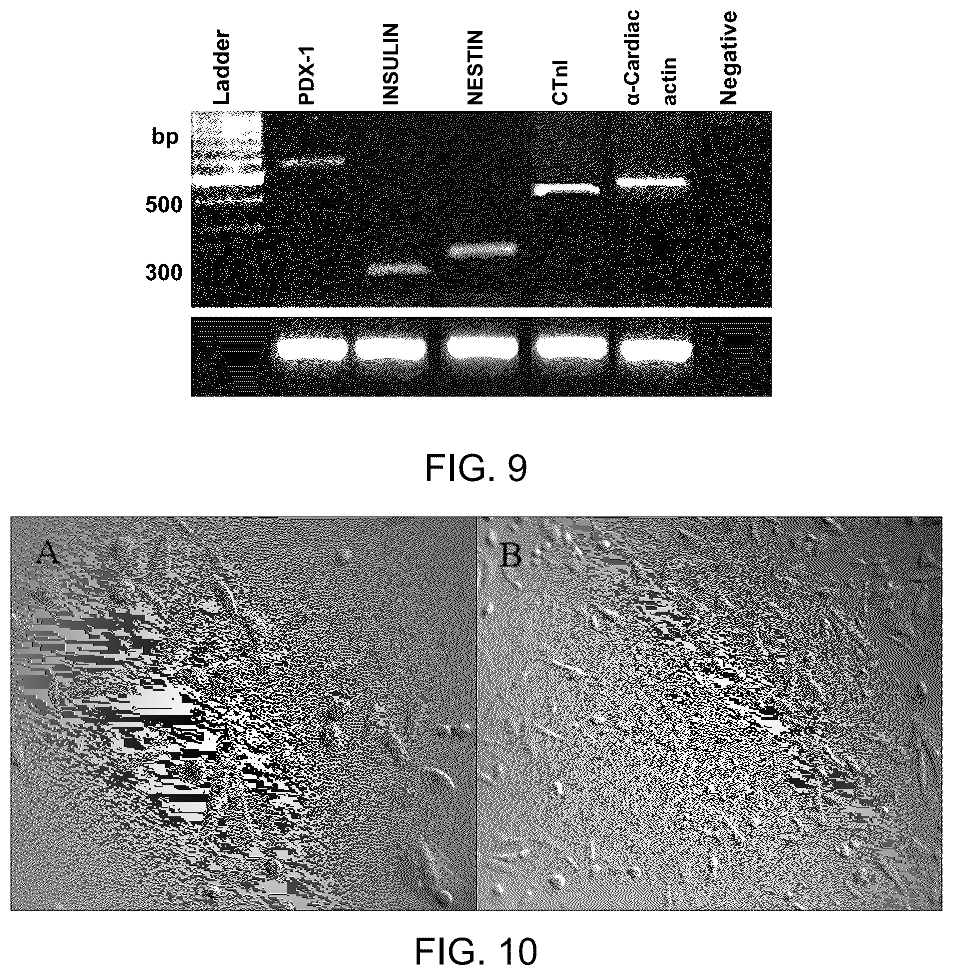 Patent US12129481 Figure 6 – Use of cells derived from first trimester umbilical cord tissue