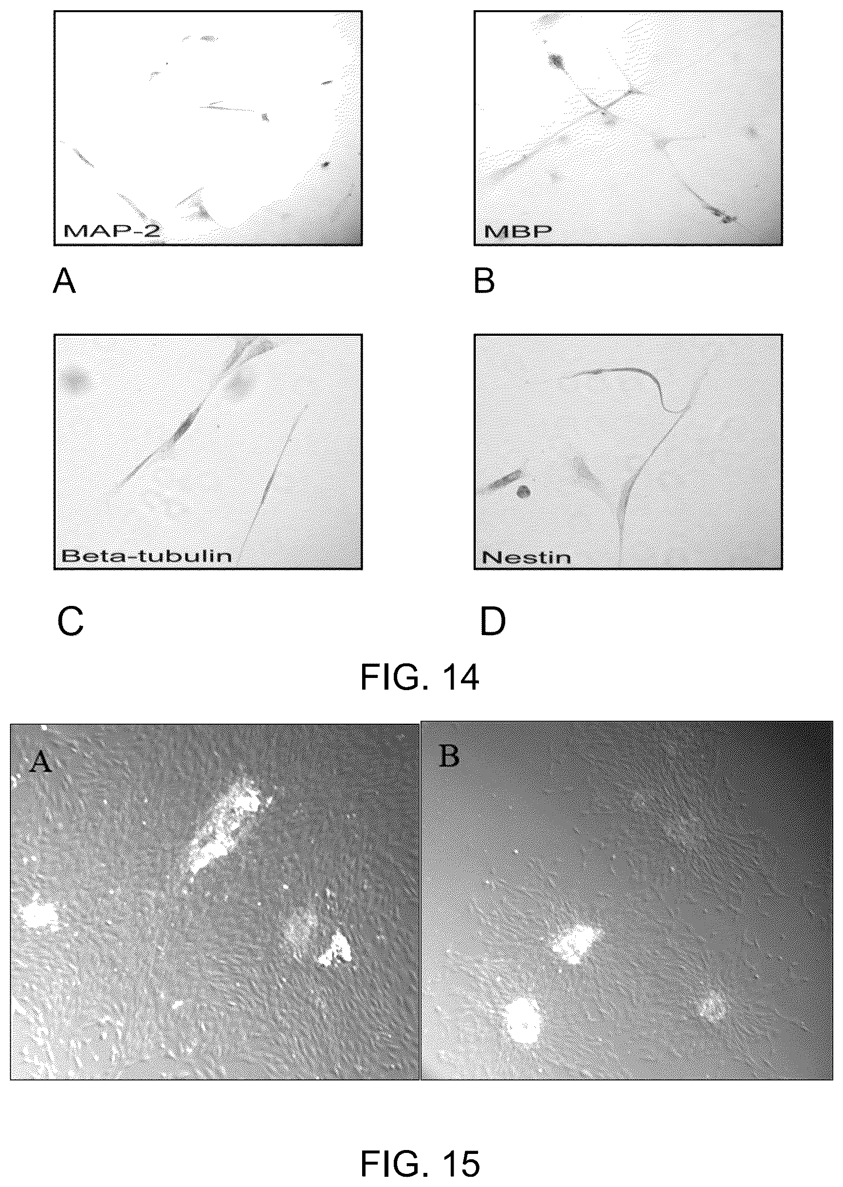 Patent US12129481 Figure 10 – Use of cells derived from first trimester umbilical cord tissue