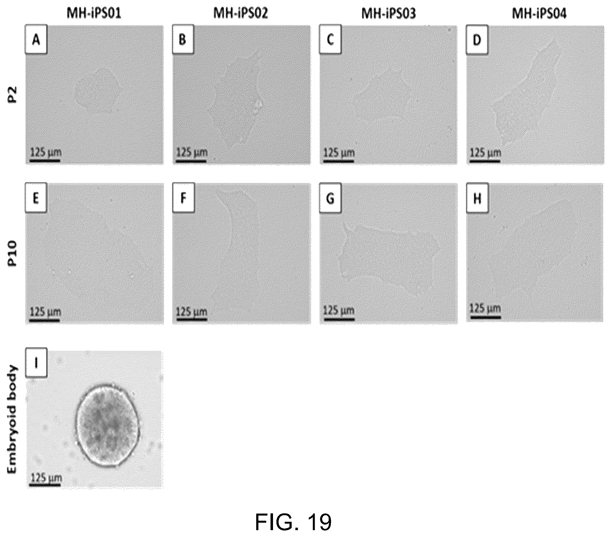 Patent US12129481 Figure 13 – Use of cells derived from first trimester umbilical cord tissue