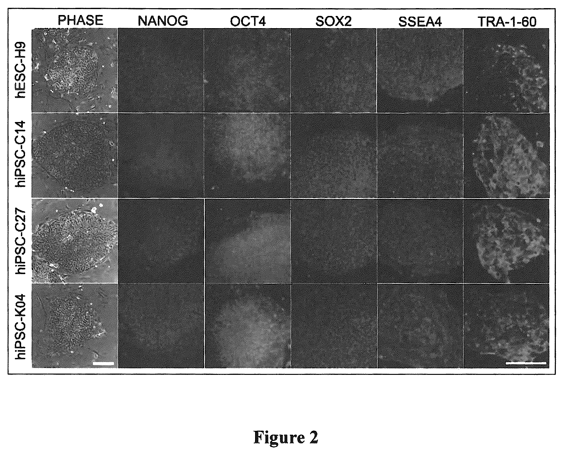 Patent US12129484 Figure 2 – Induced pluripotent cell-derived oligodendrocyte progenitor cells for the treatment of myelin disorders