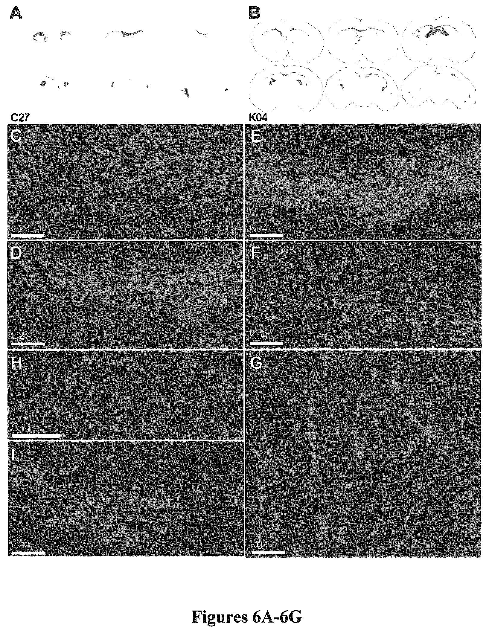 Patent US12129484 Figure 7 – Induced pluripotent cell-derived oligodendrocyte progenitor cells for the treatment of myelin disorders