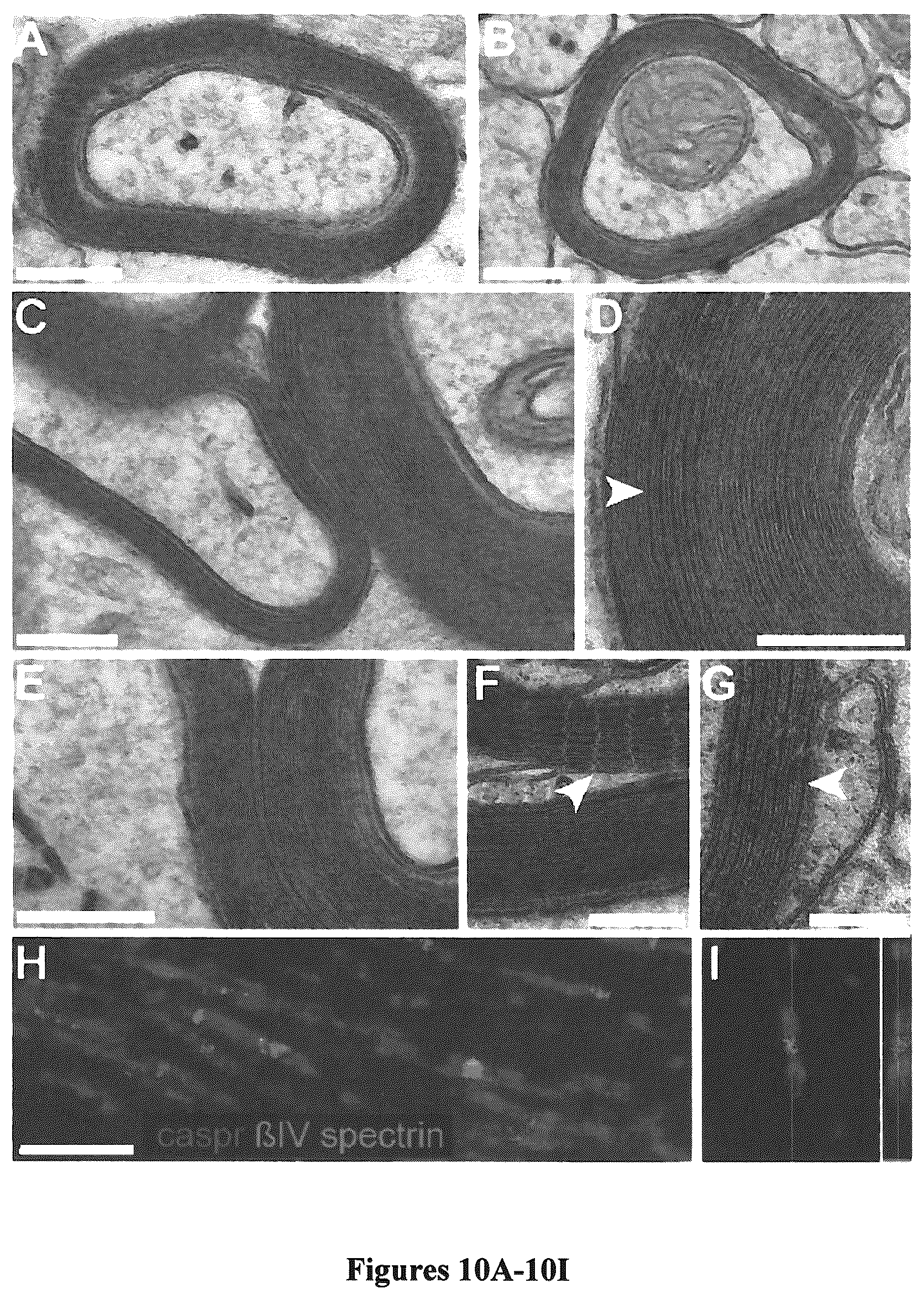 Patent US12129484 Figure 11 – Induced pluripotent cell-derived oligodendrocyte progenitor cells for the treatment of myelin disorders