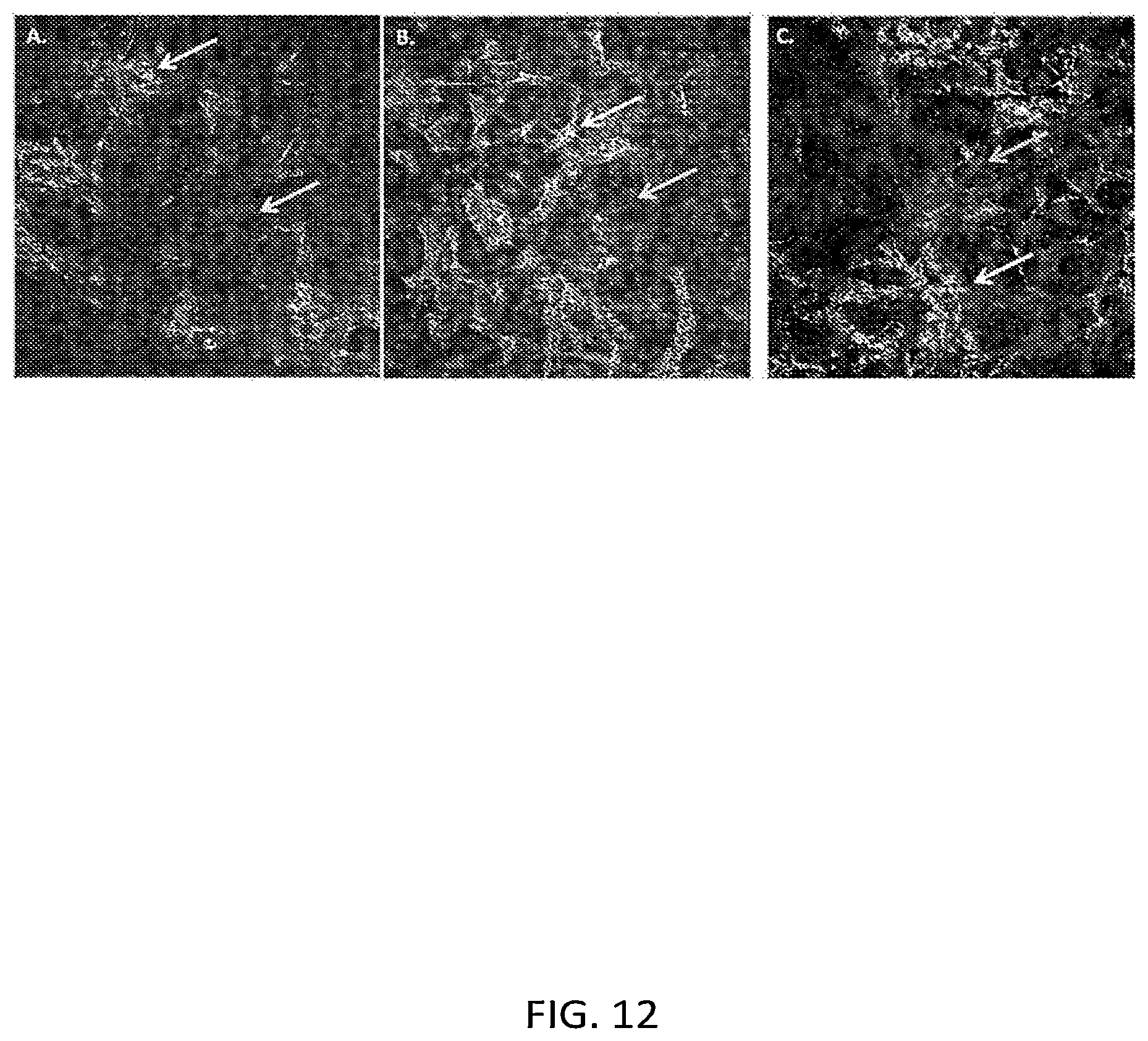 Patent US12129492 Figure 12 – Human liver microphysiology platform and self assembly liver acinus model and methods of their use