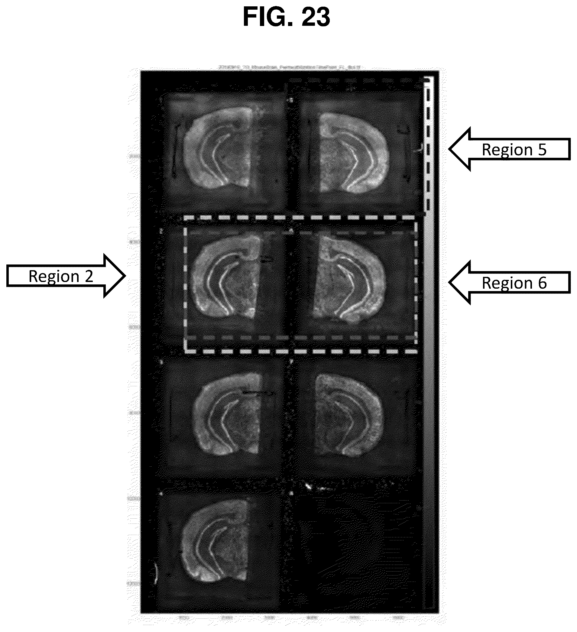 Patent US12129516 Figure 17 – Quantitative and automated permeabilization performance evaluation for spatial transcriptomics