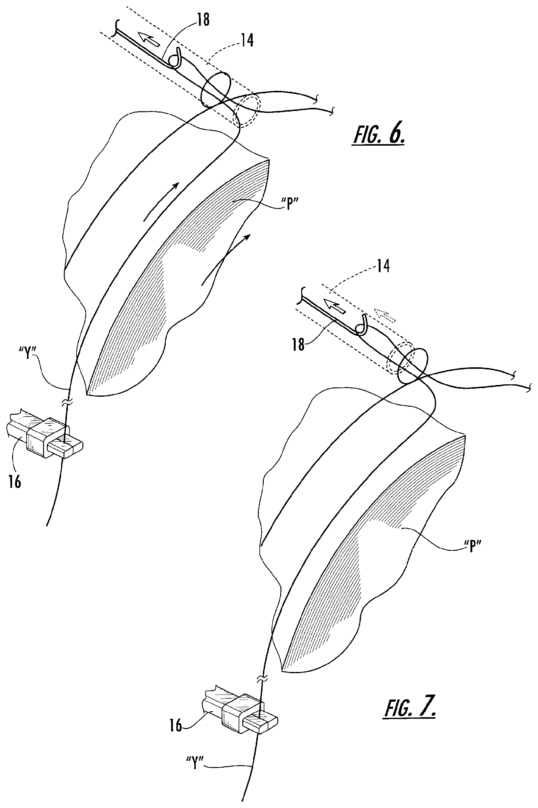Patent US12129576 Figure 4 – Automated yarn package handling system and method