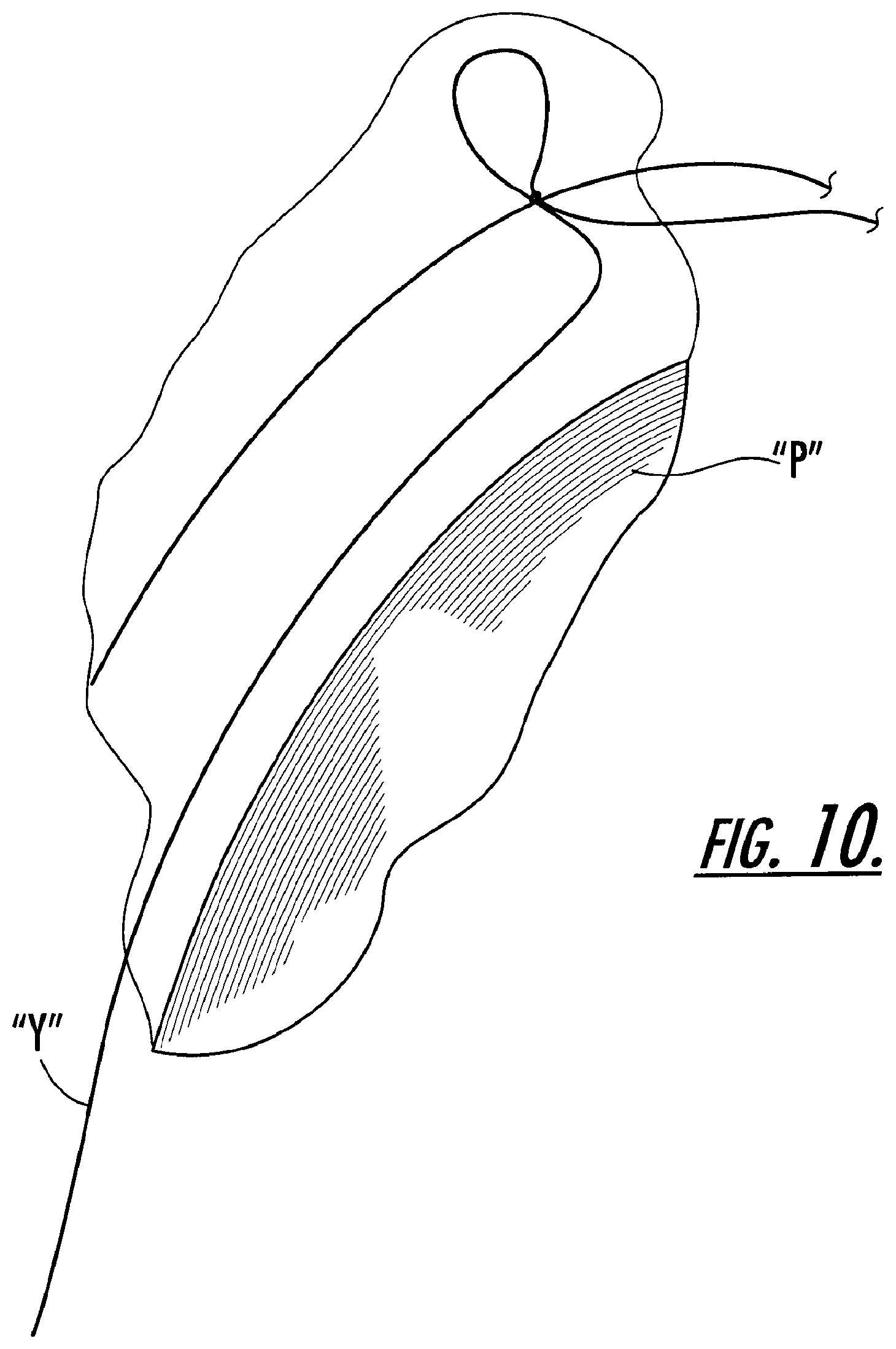 Patent US12129576 Figure 6 – Automated yarn package handling system and method